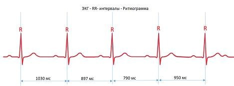 Методика «ВедаПульс» в Зеленограде позволяет диагностировать состояние физического, психологического и энергетического здоровья человека, прогнозировать риски заболеваний и предлагает профилактические меры по их устранению, а также составляет индивидуальные рекомендации по оздоровлению.