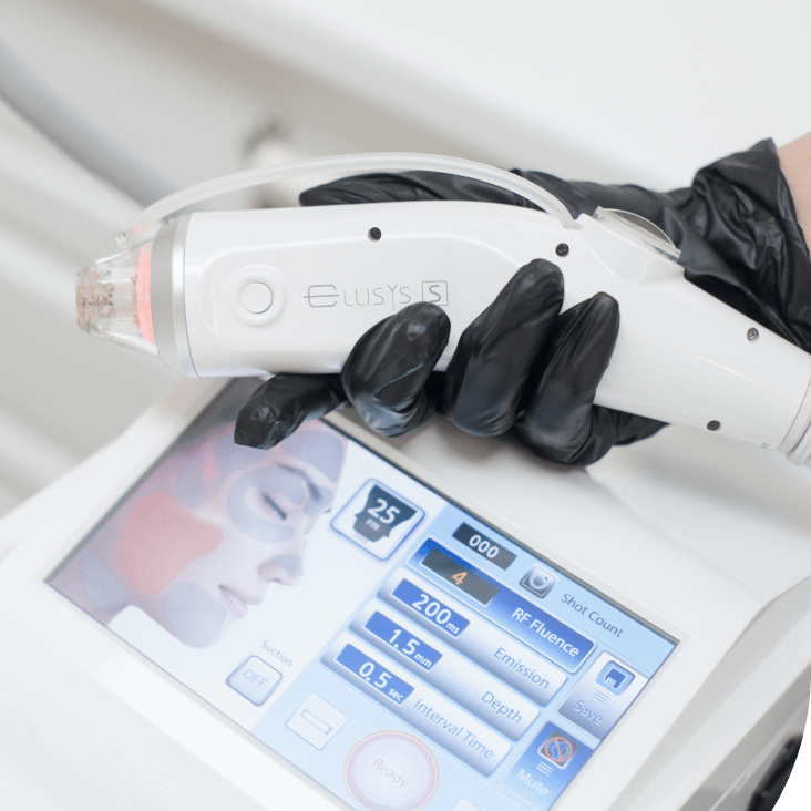 Удаление волос на лице  и теле