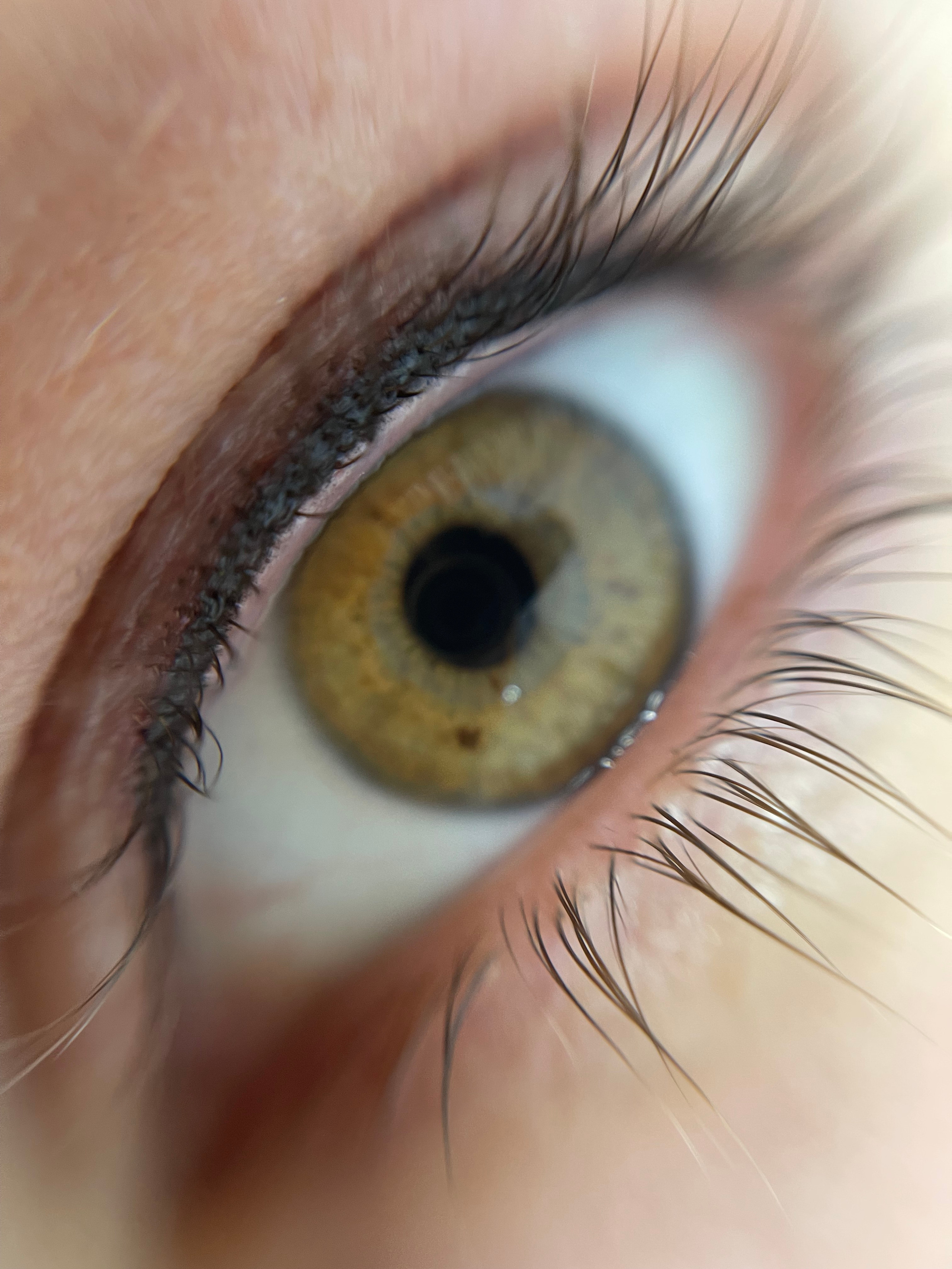 межресничка Ростов 