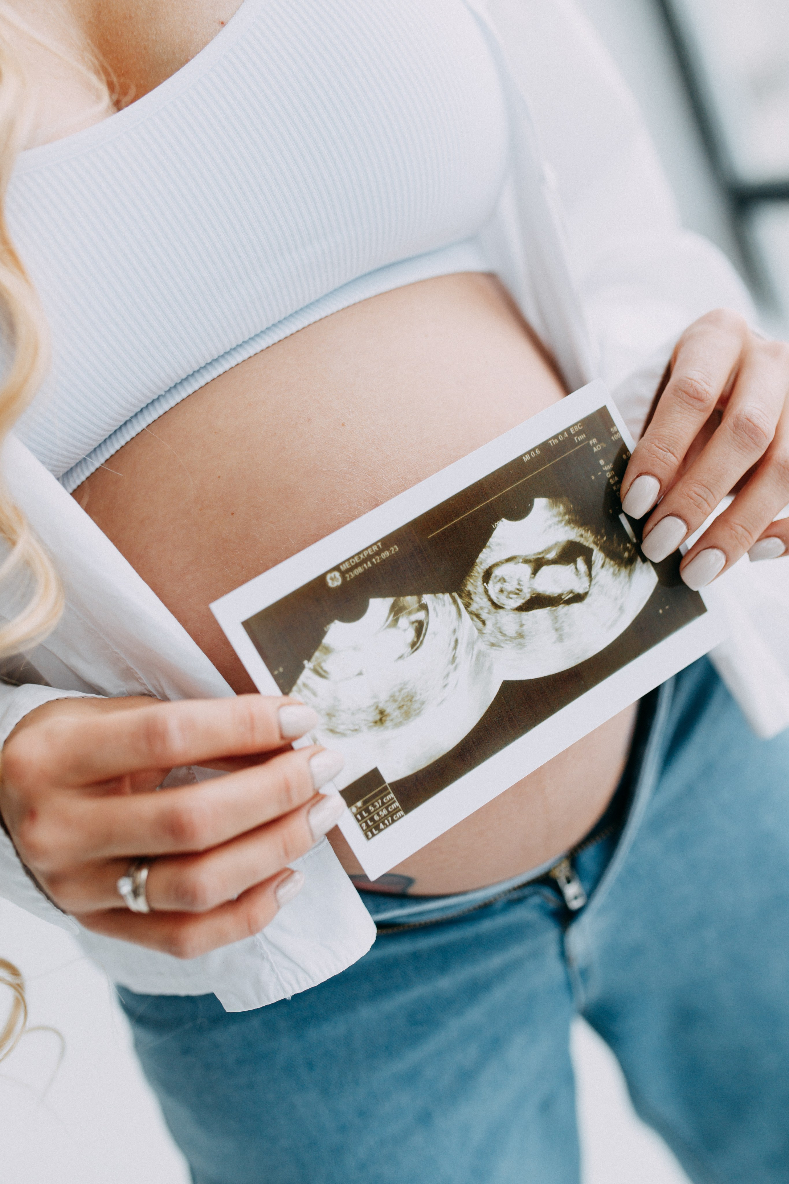 Гендер-пати • Зима 2024. Фотограф в Калининграде Екатерина Осинцева