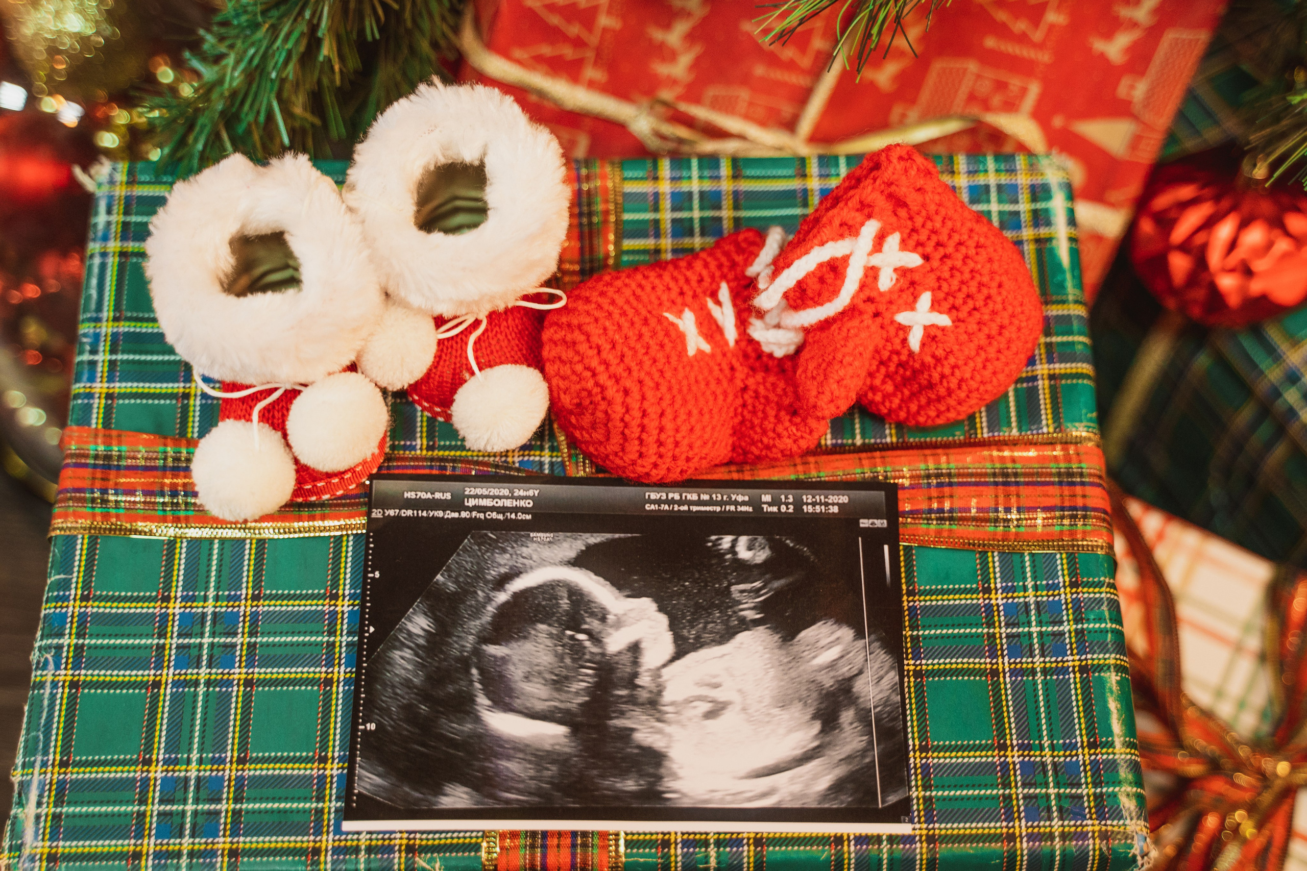 Новогодняя фотосессия беременности в студии. Анна и Кирилл. Свадебный и репортажный фотограф в Уфе| Осетрова Ольга