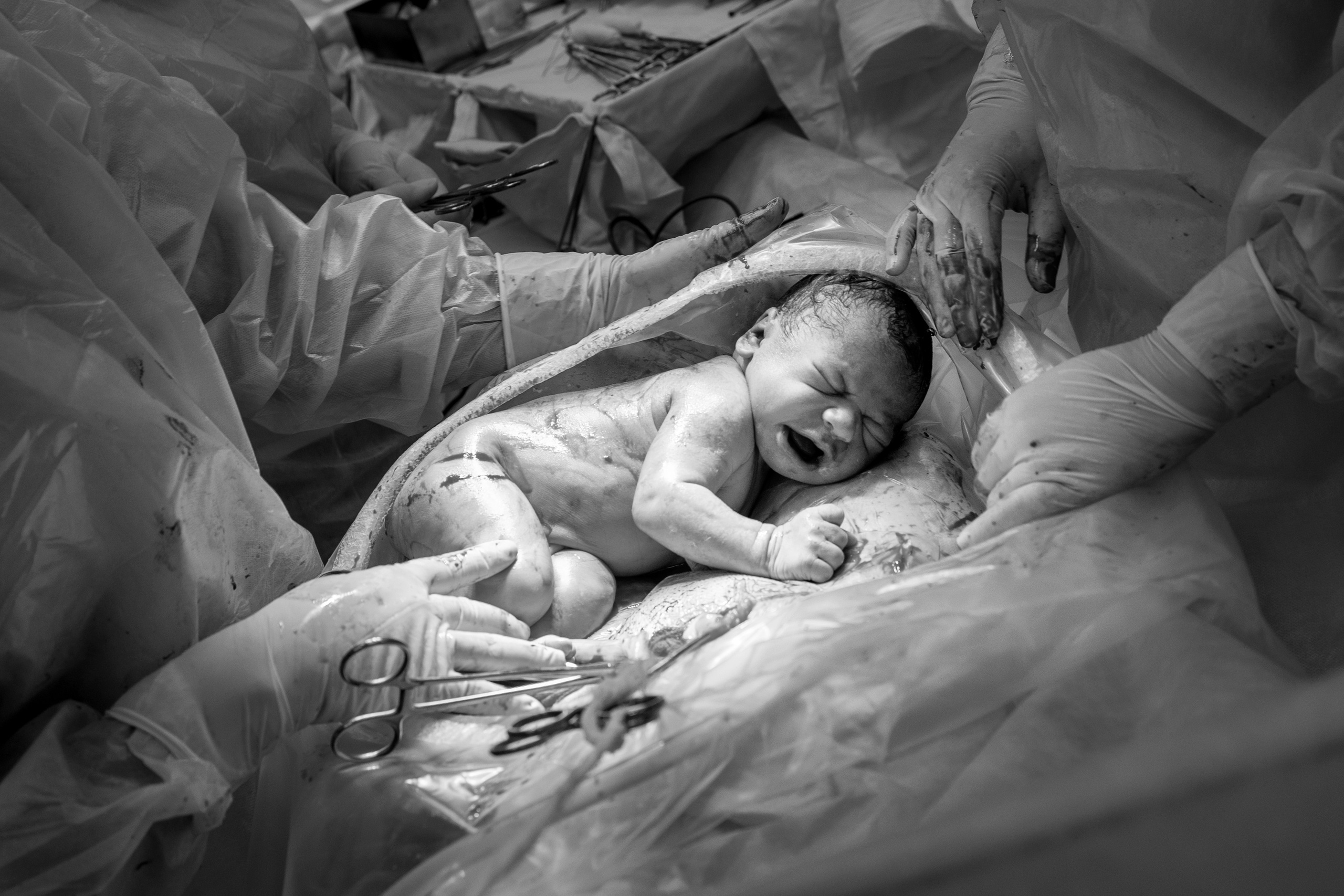 Фотография в родах