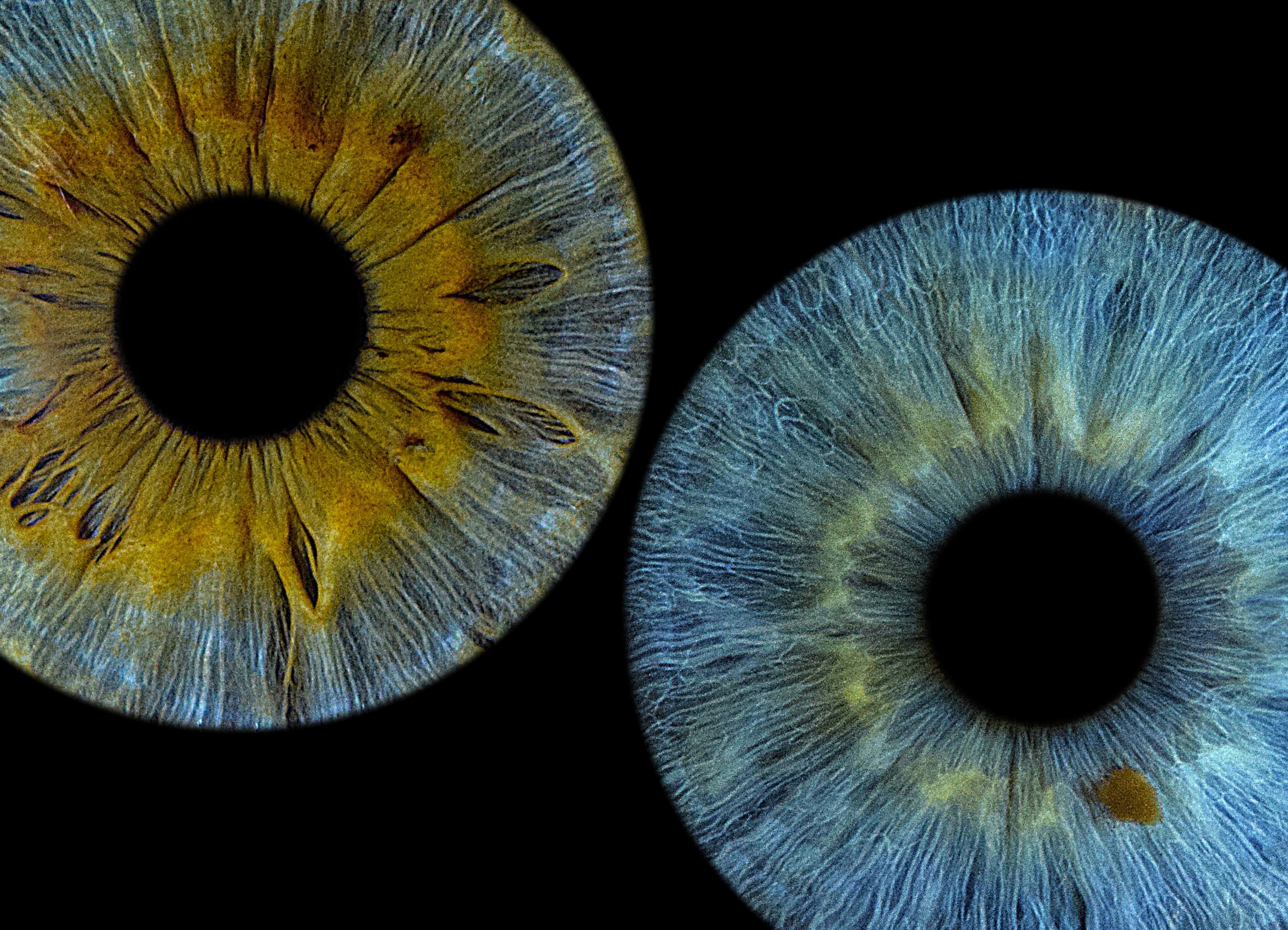 Портфолио. EYEtob | Фотография радужной оболочки | Тобольск