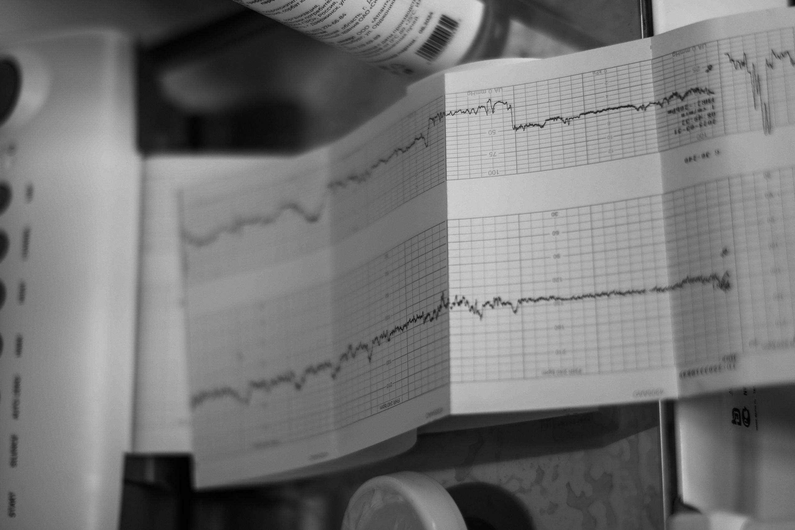 Рождение Евсея. Фотограф Олеся Милош Мытищи, Москва и МО и весь мир