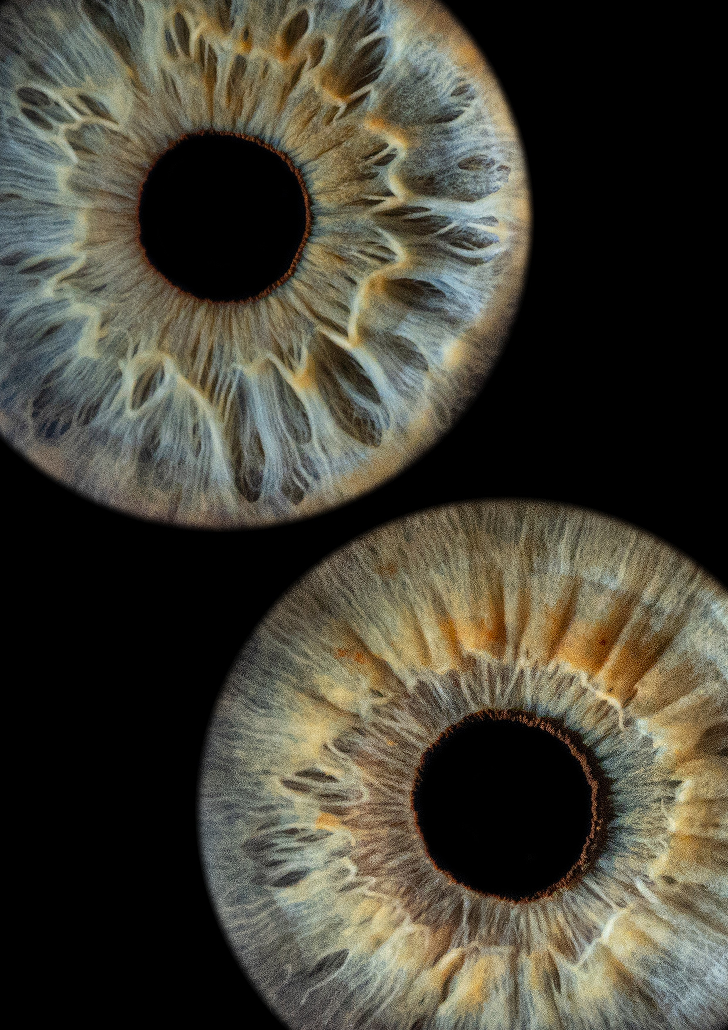 Примеры работ. Мой глаз