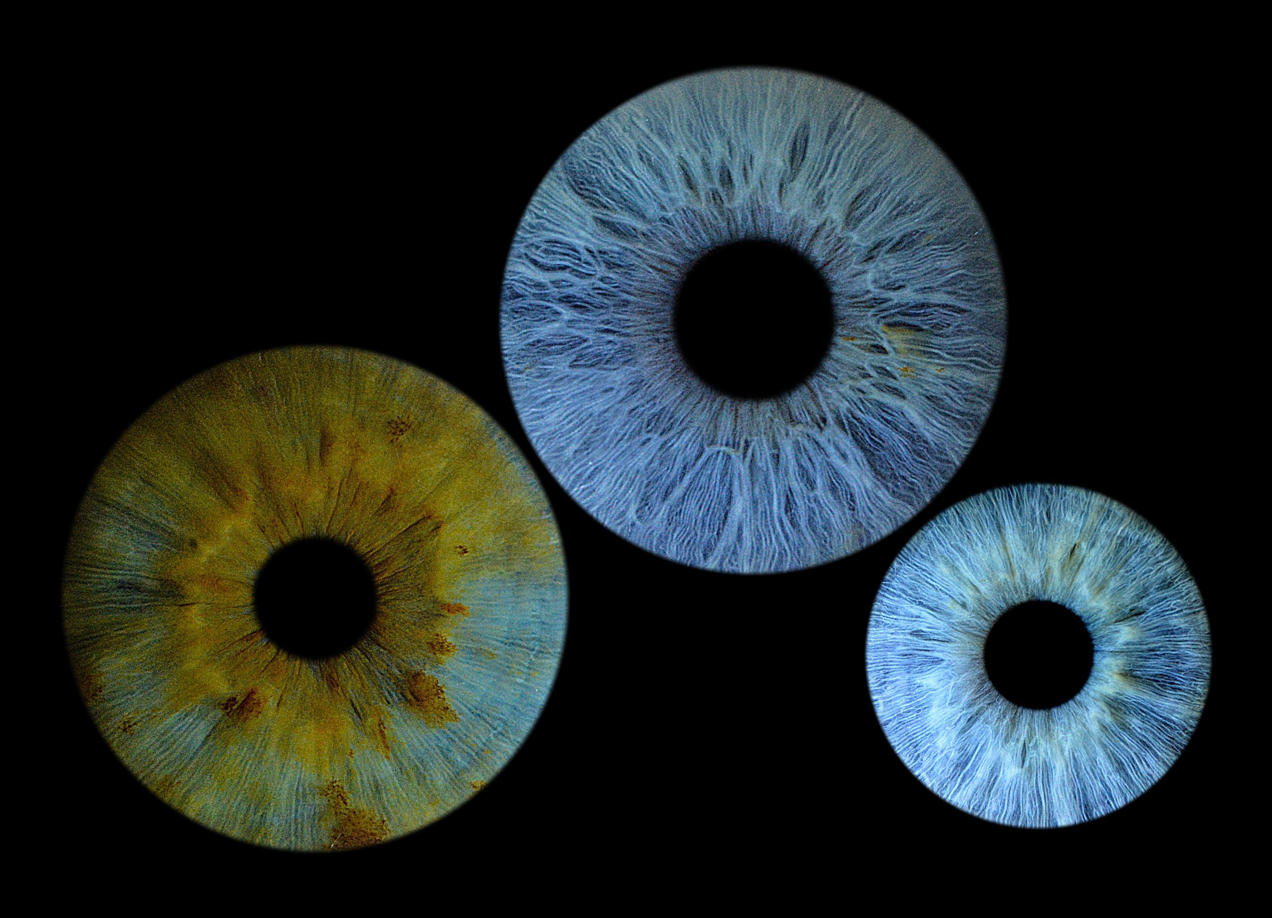 Портфолио. EYEtob | Фотография радужной оболочки | Тобольск