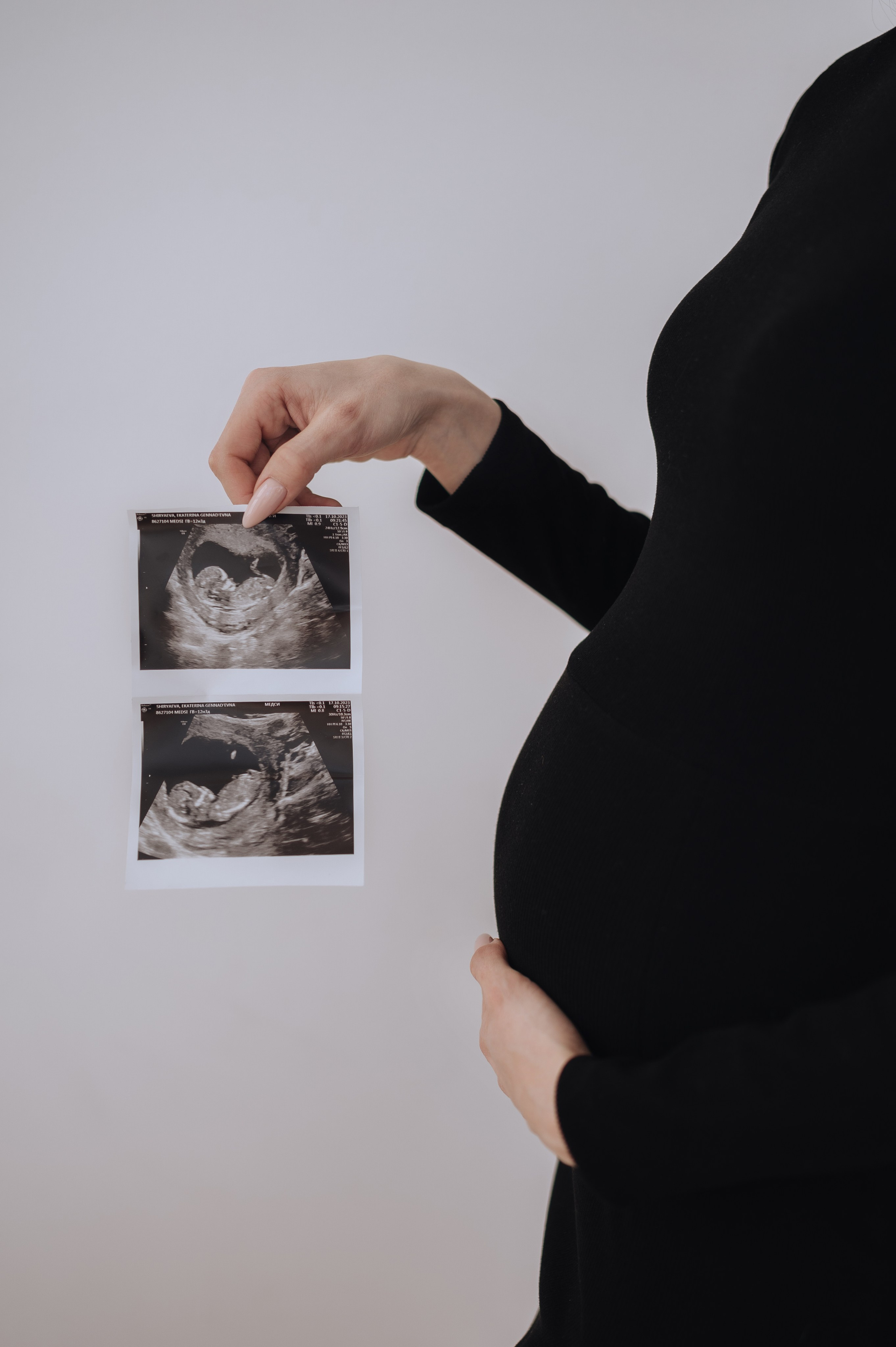 Фотосессия беременности Ромы и Кати. Фотограф в Москве и Московской области Таня Яблочкина