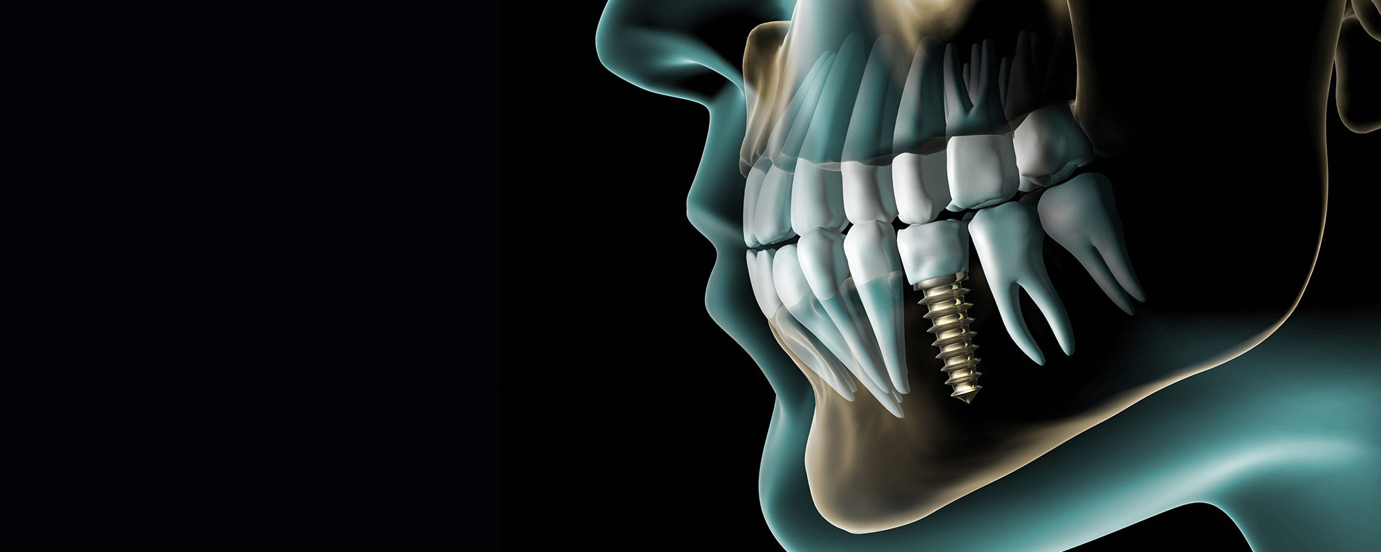 Стоматолог хирург-имплантолог Иванов Андрей Анатольевич
