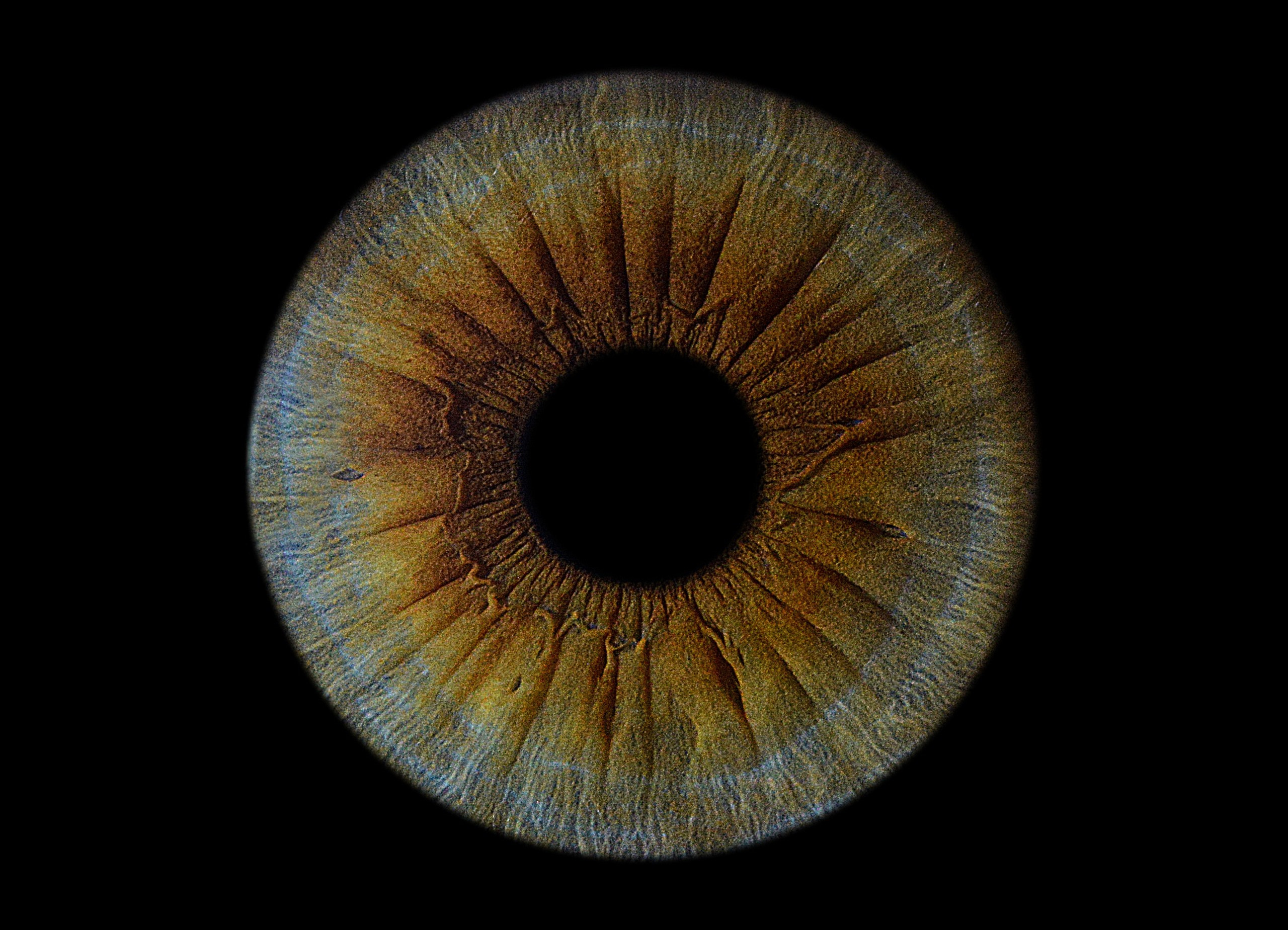 Портфолио. EYEtob | Фотография радужной оболочки | Тобольск