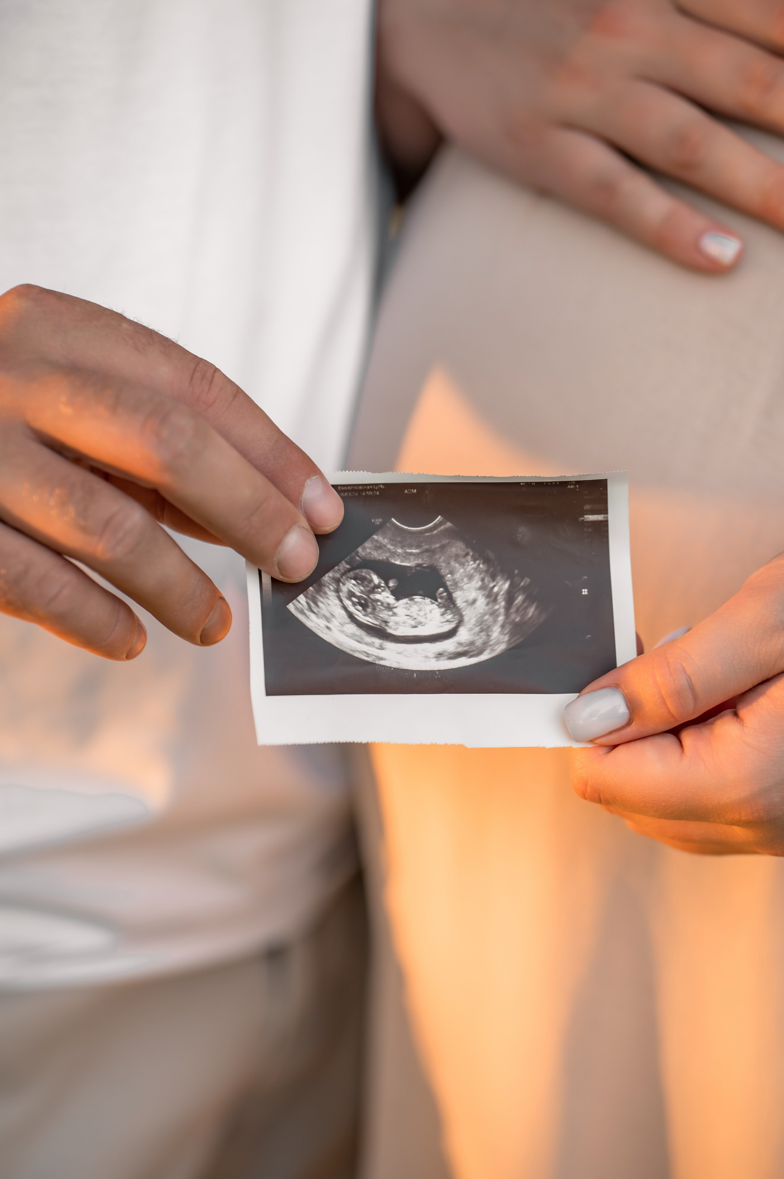 В ОЖИДАНИИ ЧУДА. Свадебный и семейный фотограф в Краснодарском крае