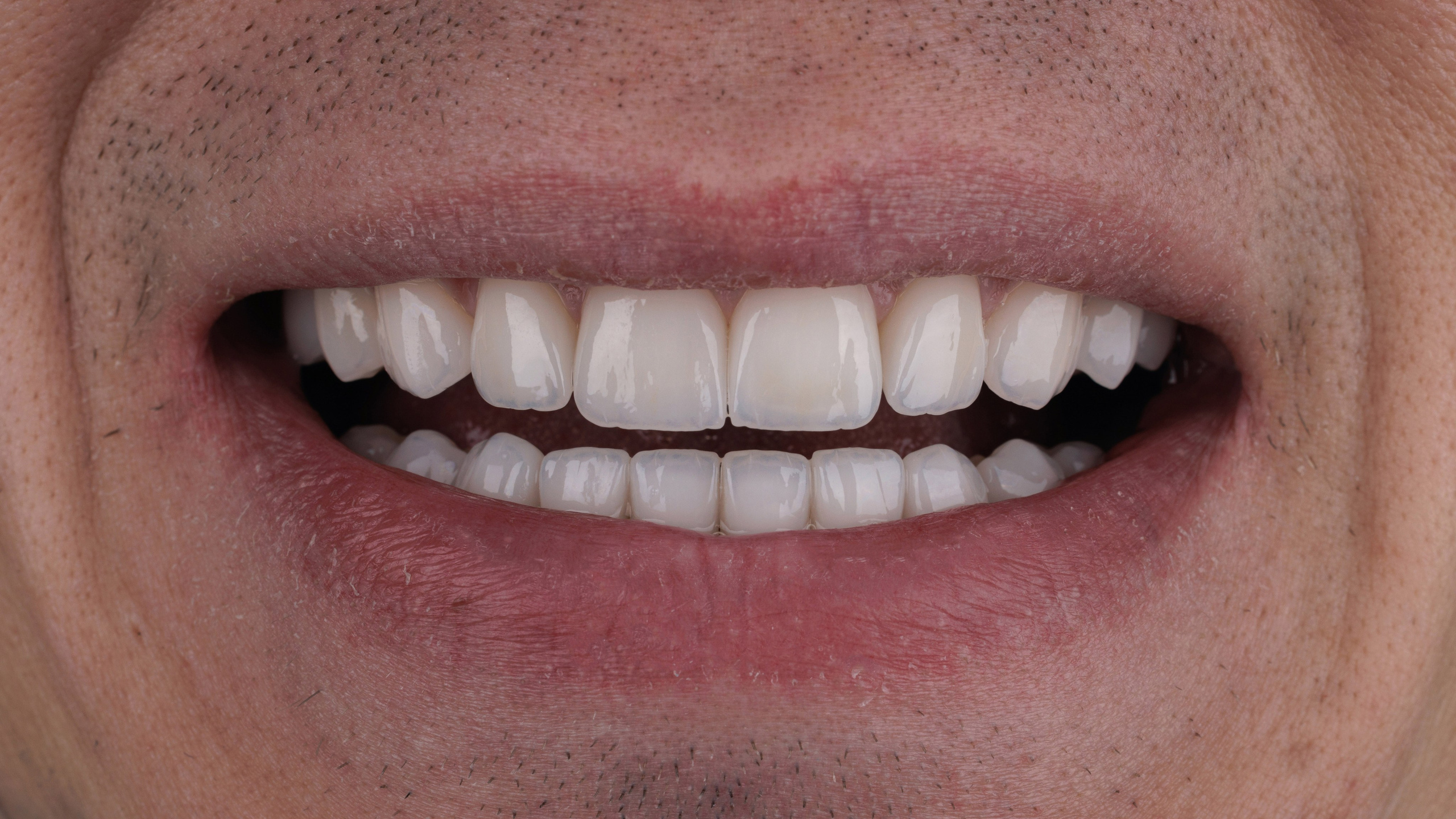 Ортопедия. Дентал фотограф — видеограф Денис Дорошенко