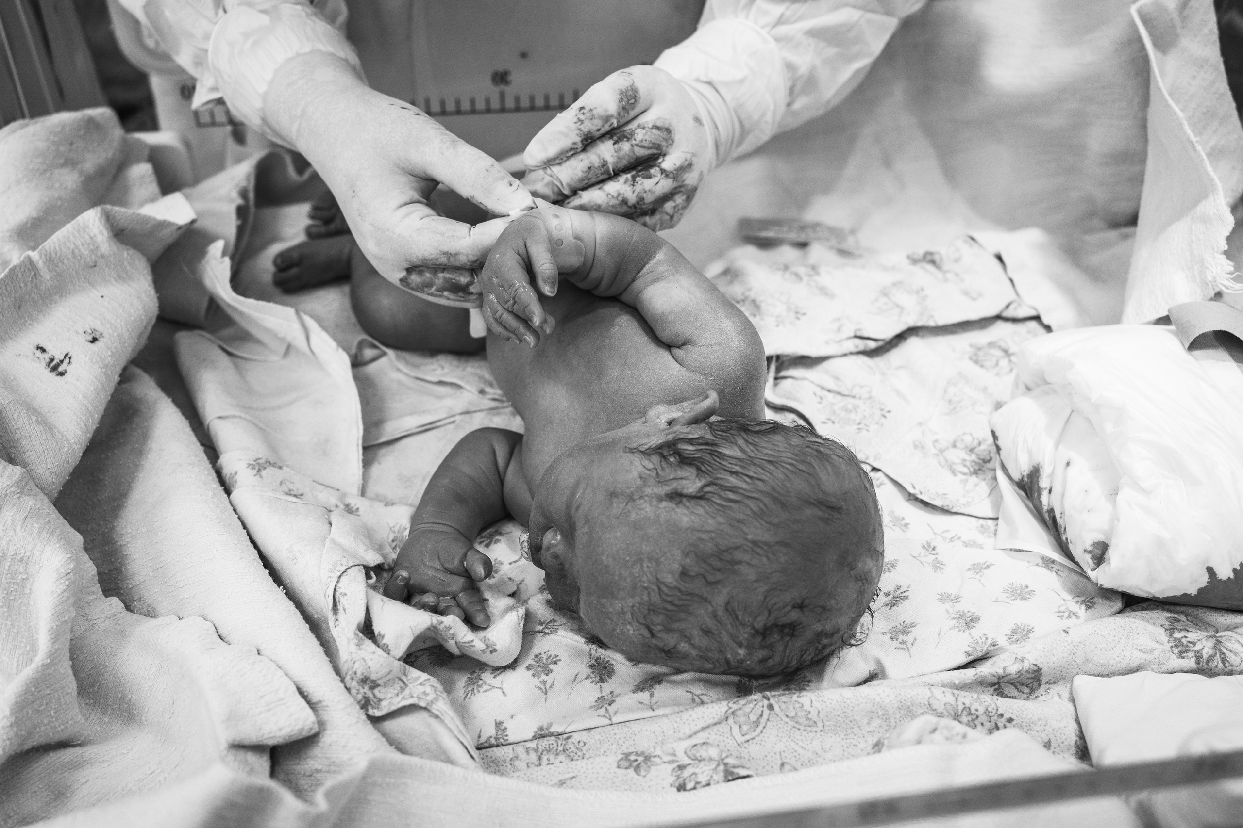 роды через воду