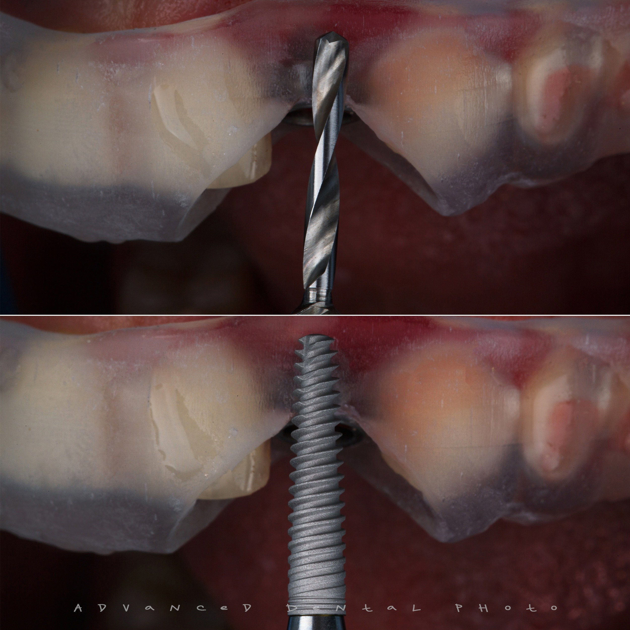 Хирургия. Дентал фотограф — видеограф Денис Дорошенко