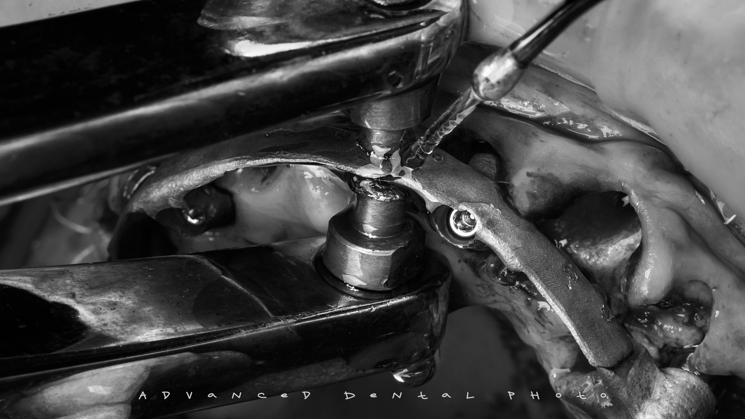 Хирургия. Дентал фотограф — видеограф Денис Дорошенко