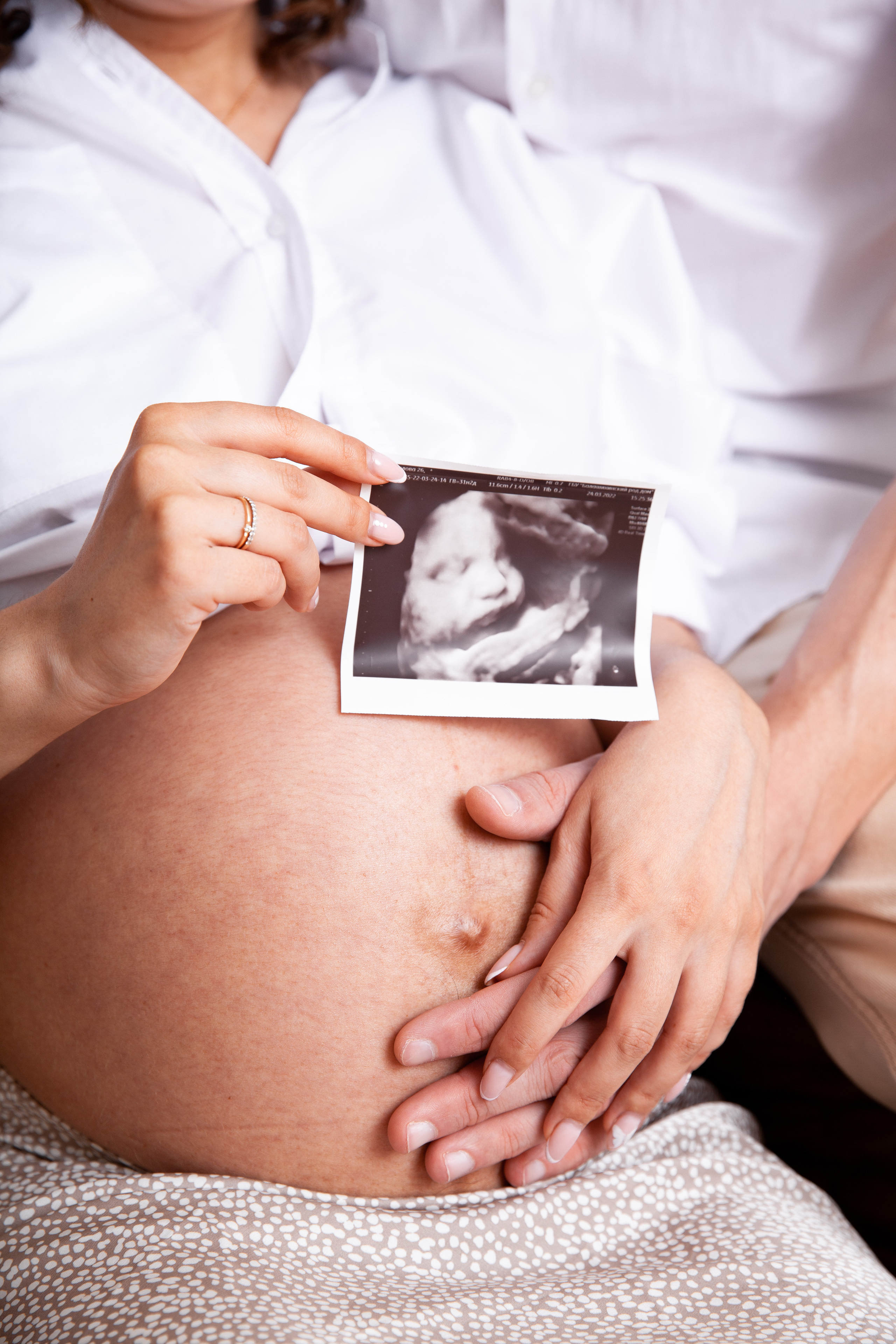 Живот 33 недели