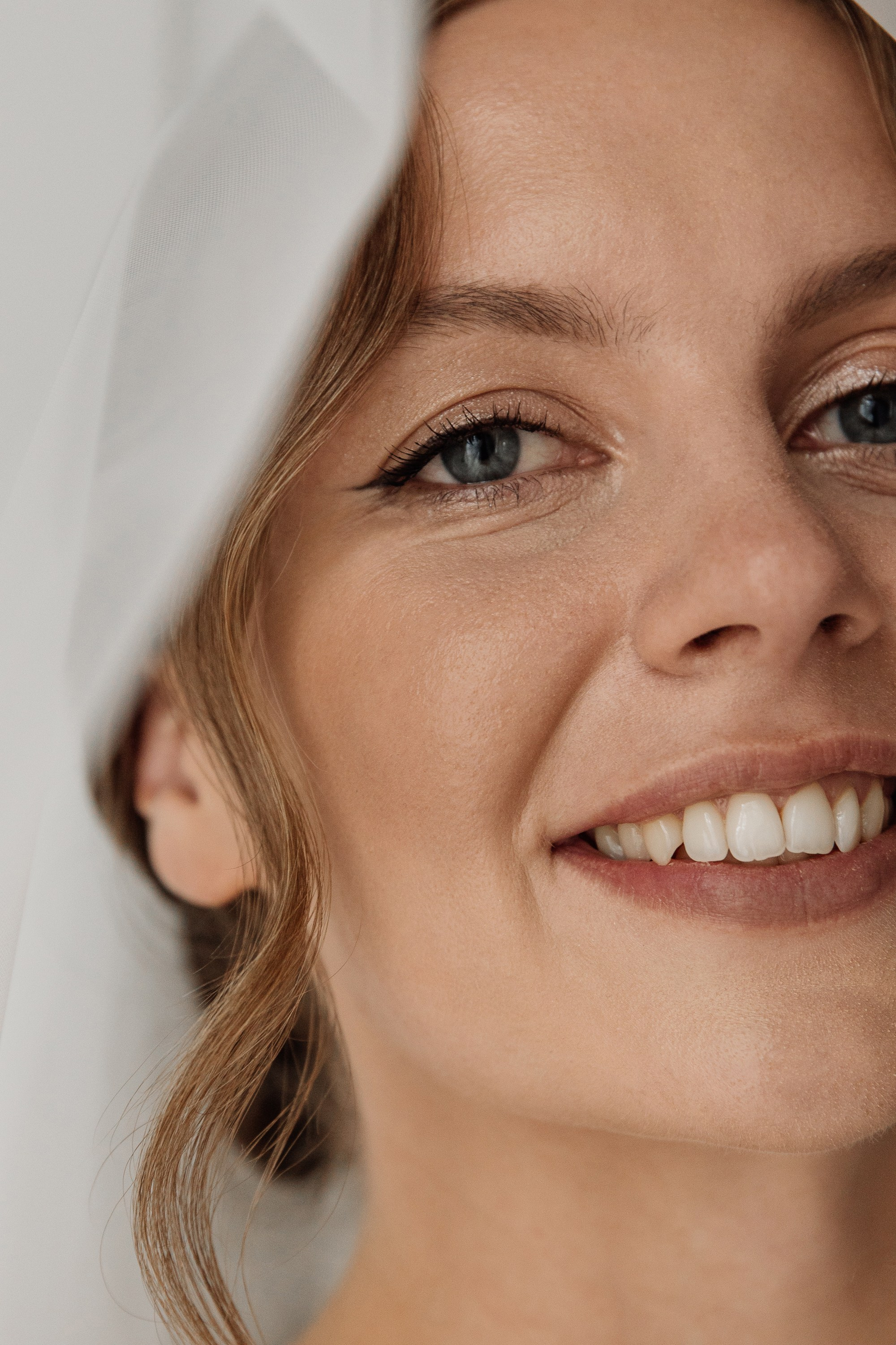 Елки-парк. Свадебный фотограф Дмитрий Воробьев Ярославль