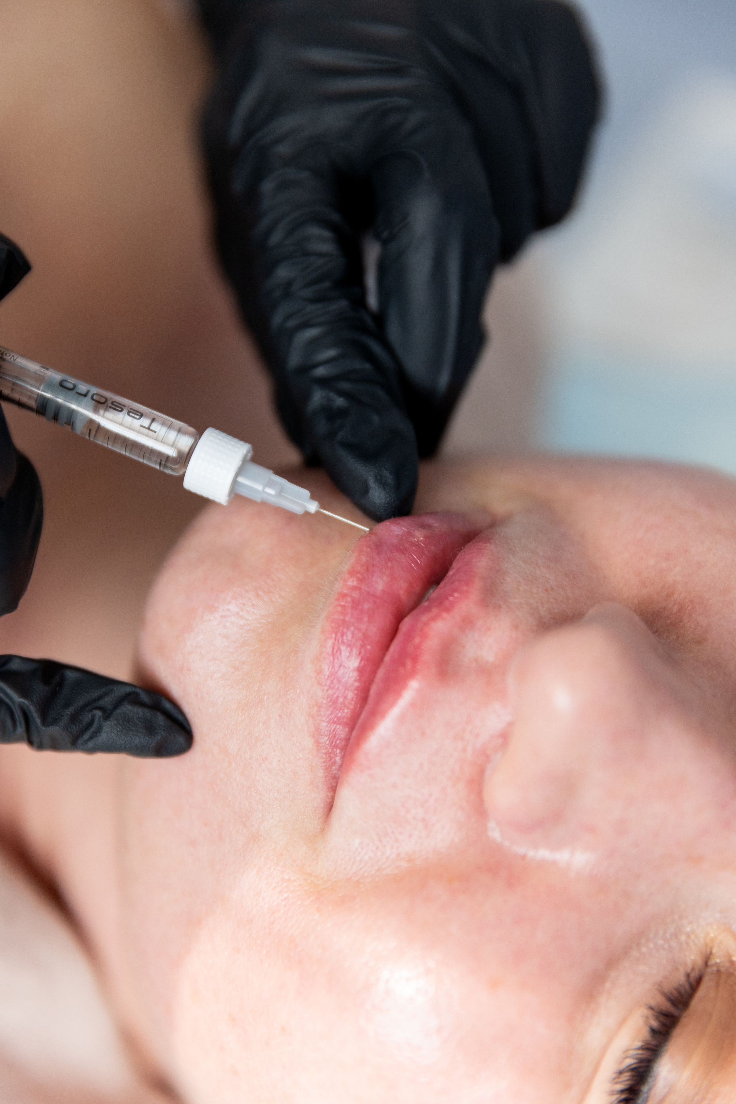 Наталья. Инъекционная косметология