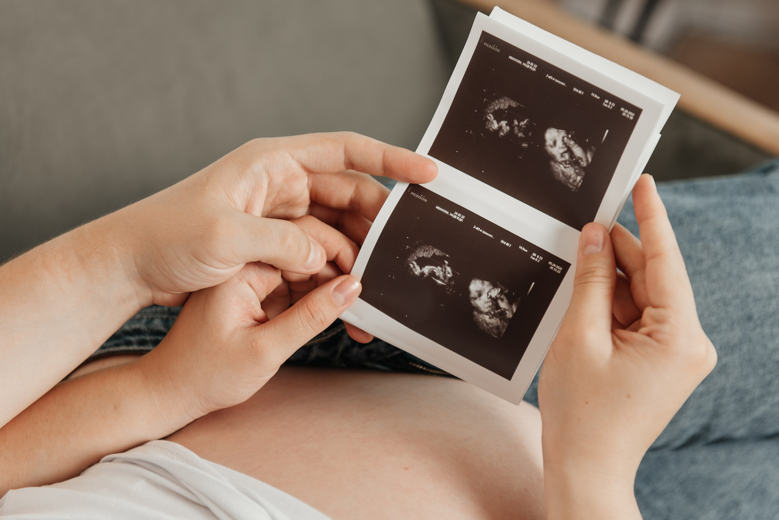 В ОЖИДАНИИ. ДИНА МИХНЕВА спортивный фотограф Москва