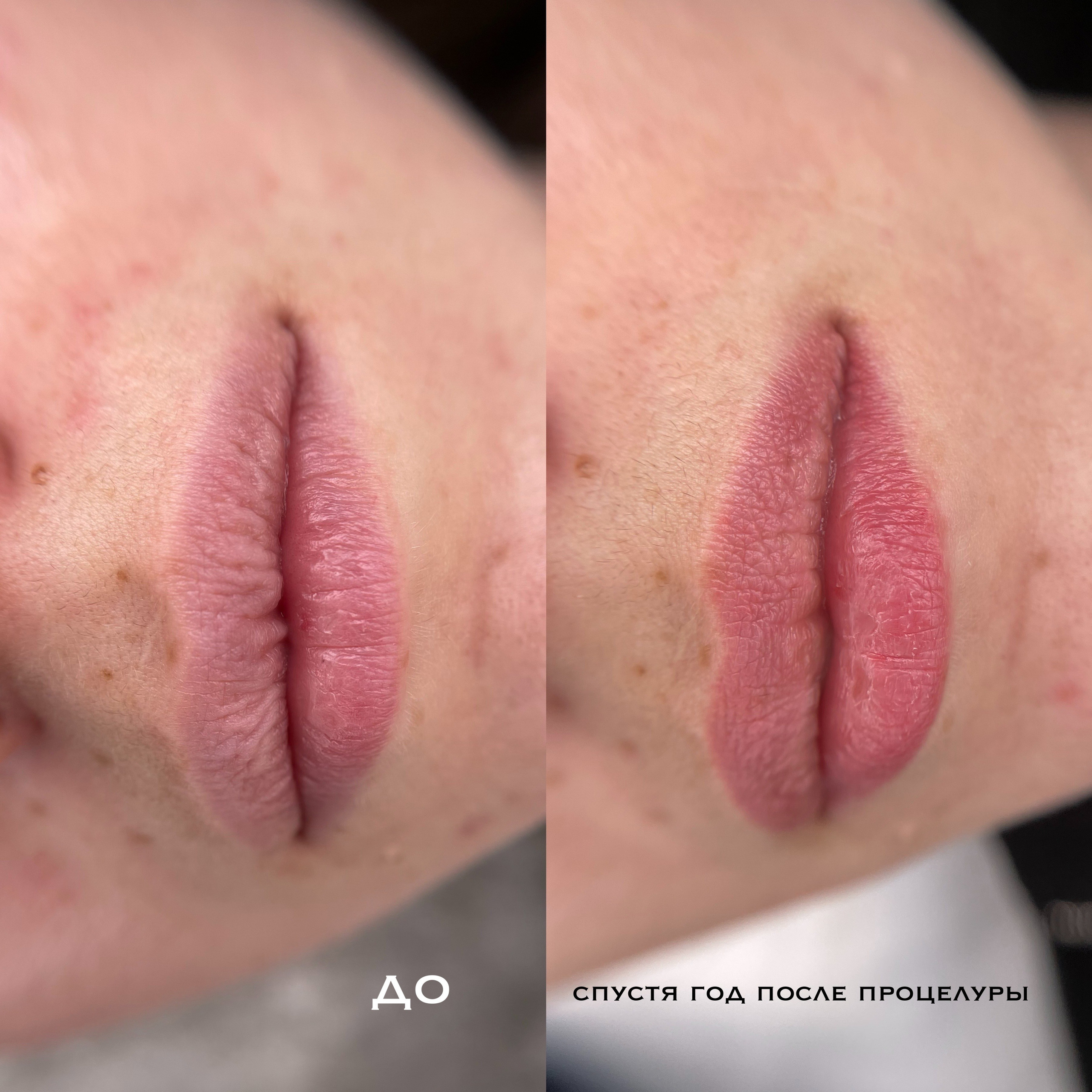 СПУСТЯ ВРЕМЯ. Перманентный макияж и удаление старого татуажа в Ростове-на-Дону Дарья Исакова