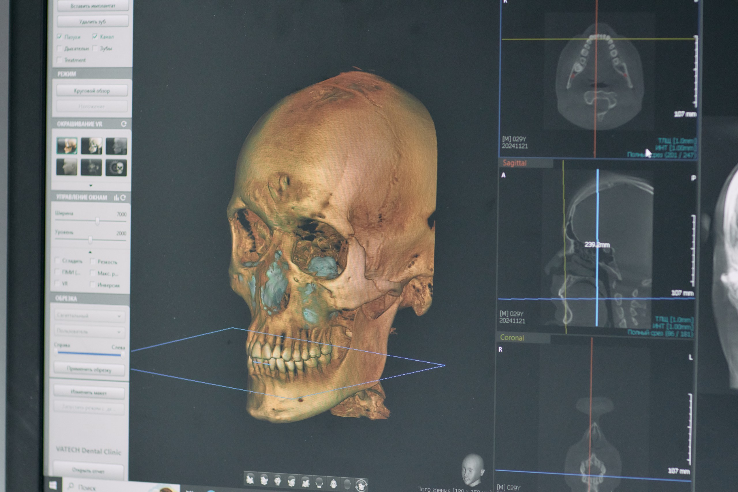 Дентал Салон 2026: Vatech. Свадебный и репортажный фотограф Дмитрий Кононенко