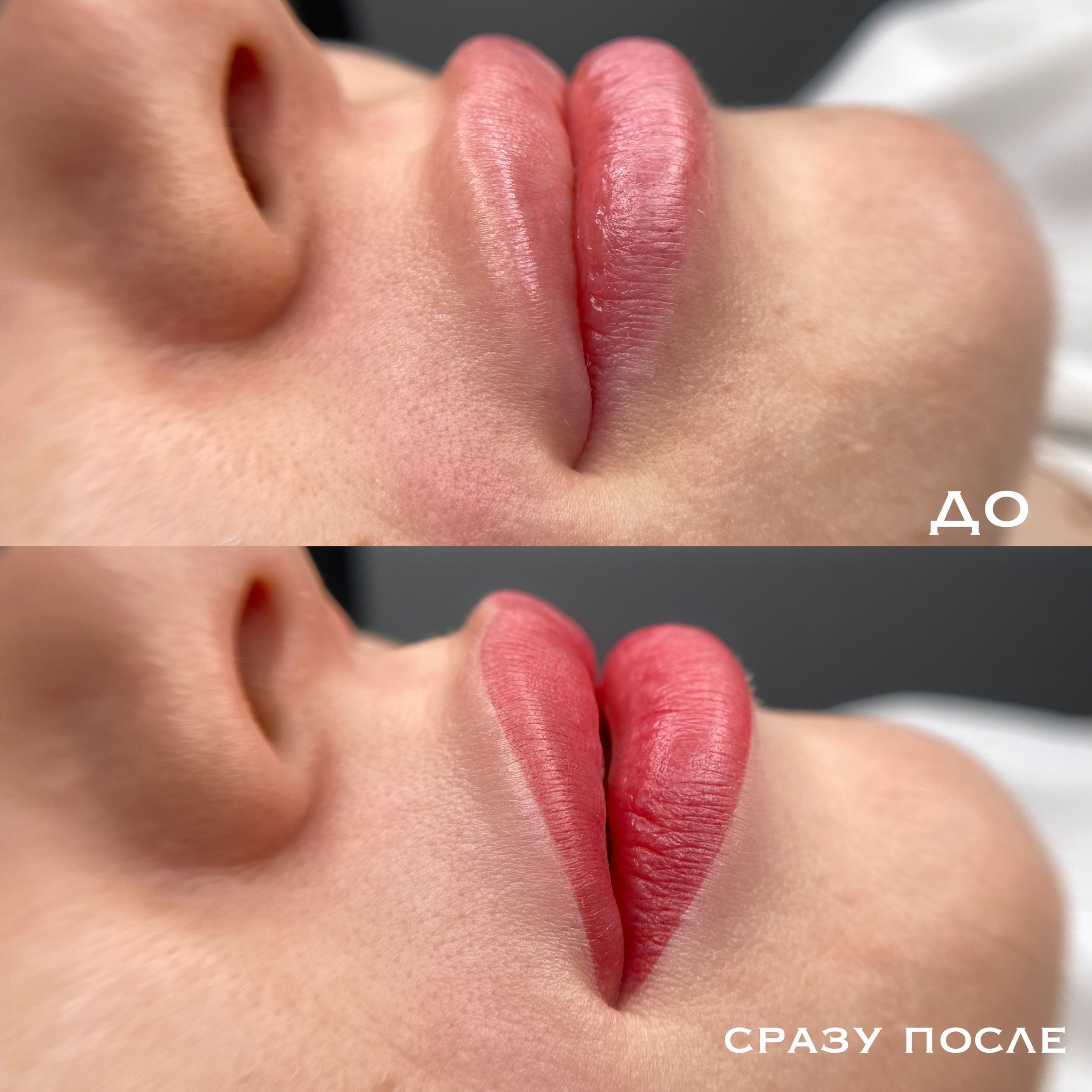 ГУБЫ сразу после процедуры. Перманентный макияж и удаление старого татуажа в Ростове-на-Дону Дарья Исакова