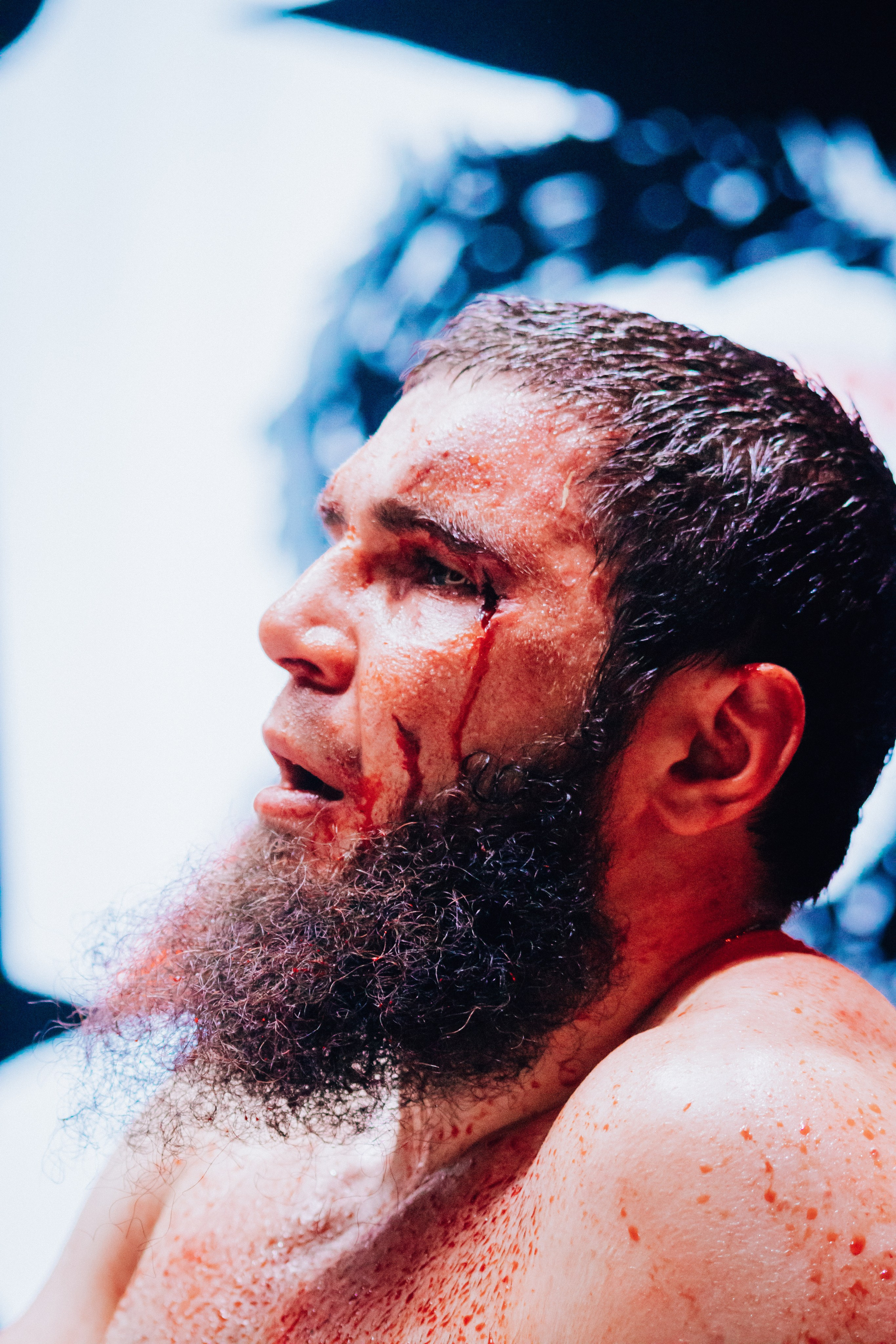 Кулачные бои TopDog. Анастасия Тен