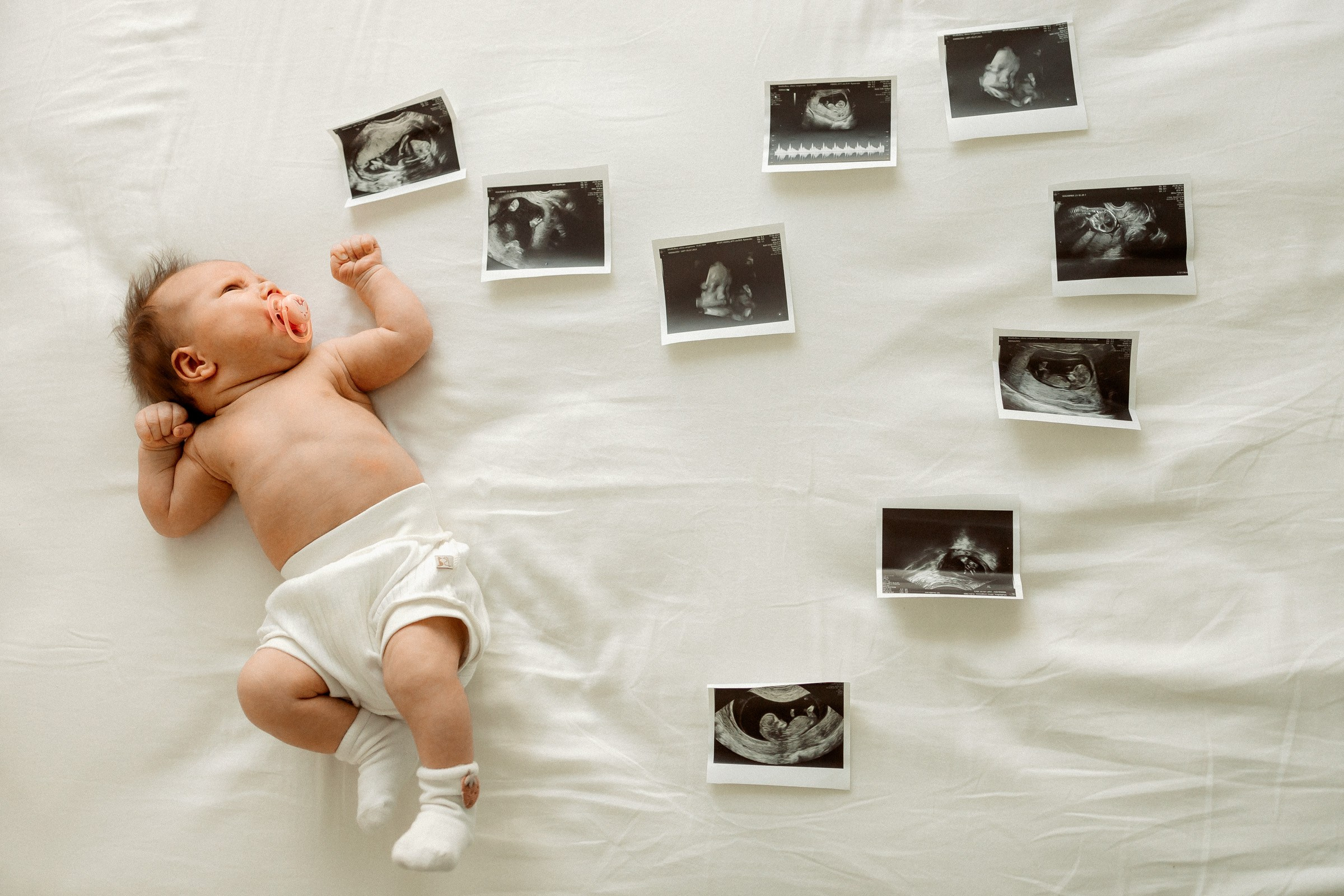 Эмилии 1 месяц