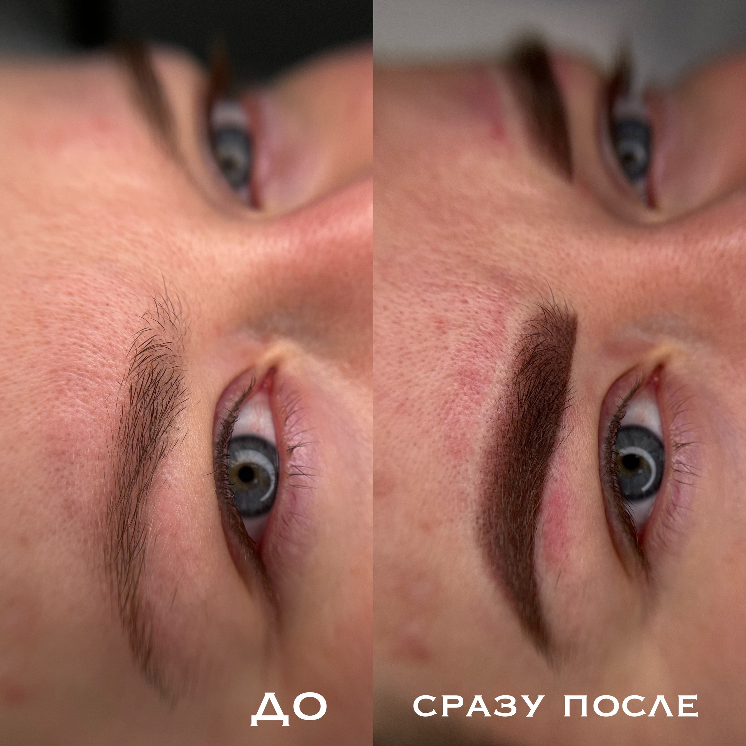 БРОВИ сразу после процедуры. Перманентный макияж и удаление старого татуажа в Ростове-на-Дону Дарья Исакова