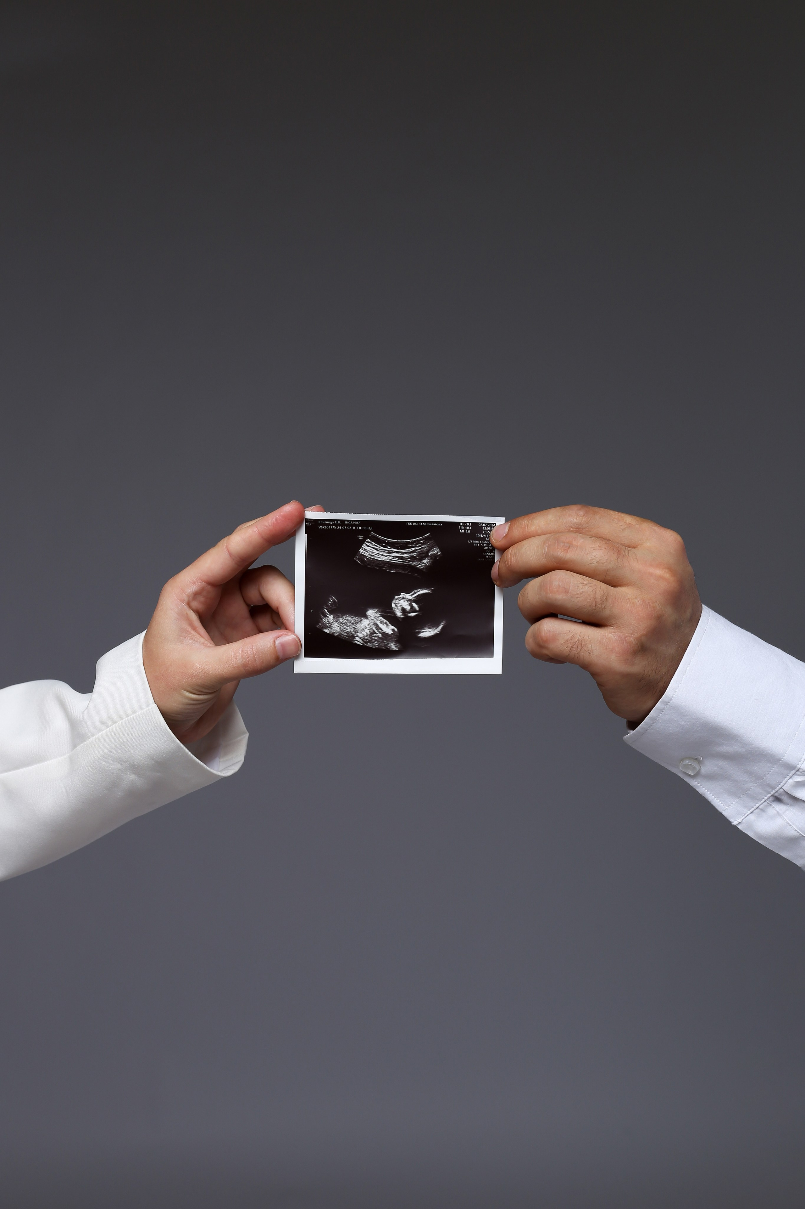 Фотосессия беременности в Железнодорожном и Балашихе