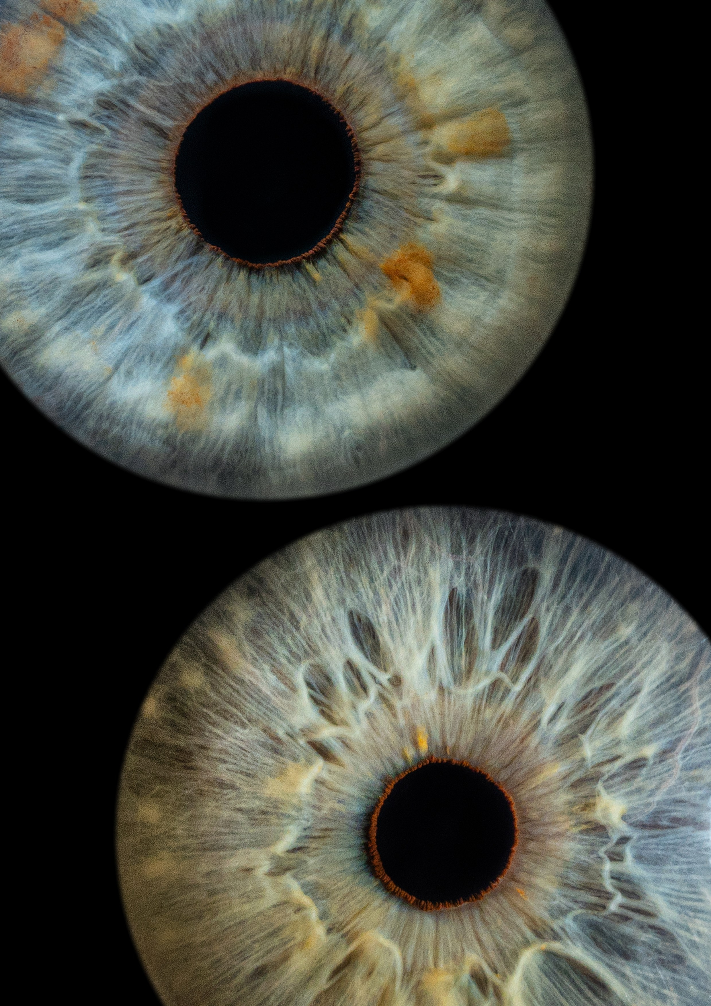 Примеры работ. Мой глаз