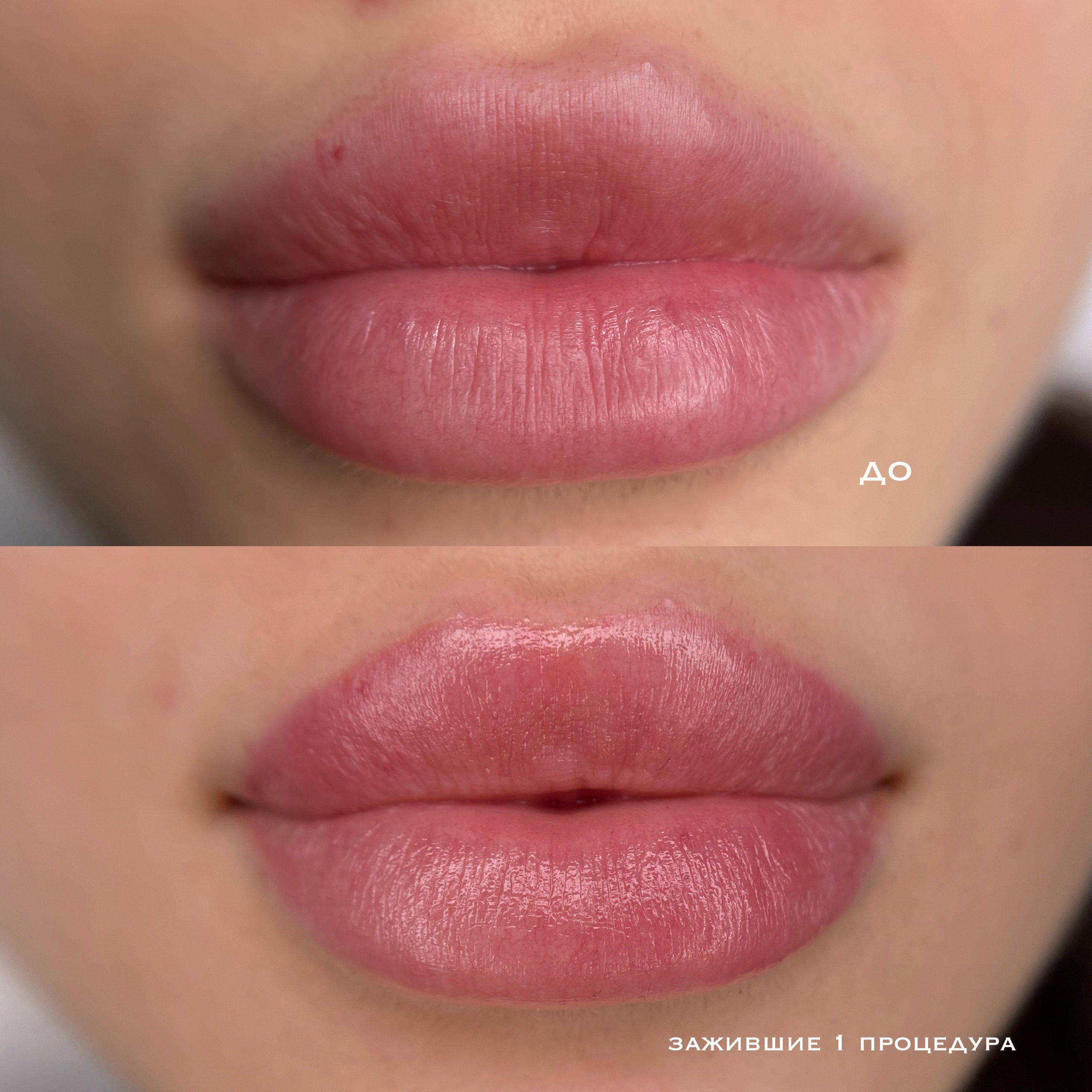 ГУБЫ зажившие. Перманентный макияж и удаление старого татуажа в Ростове-на-Дону Дарья Исакова