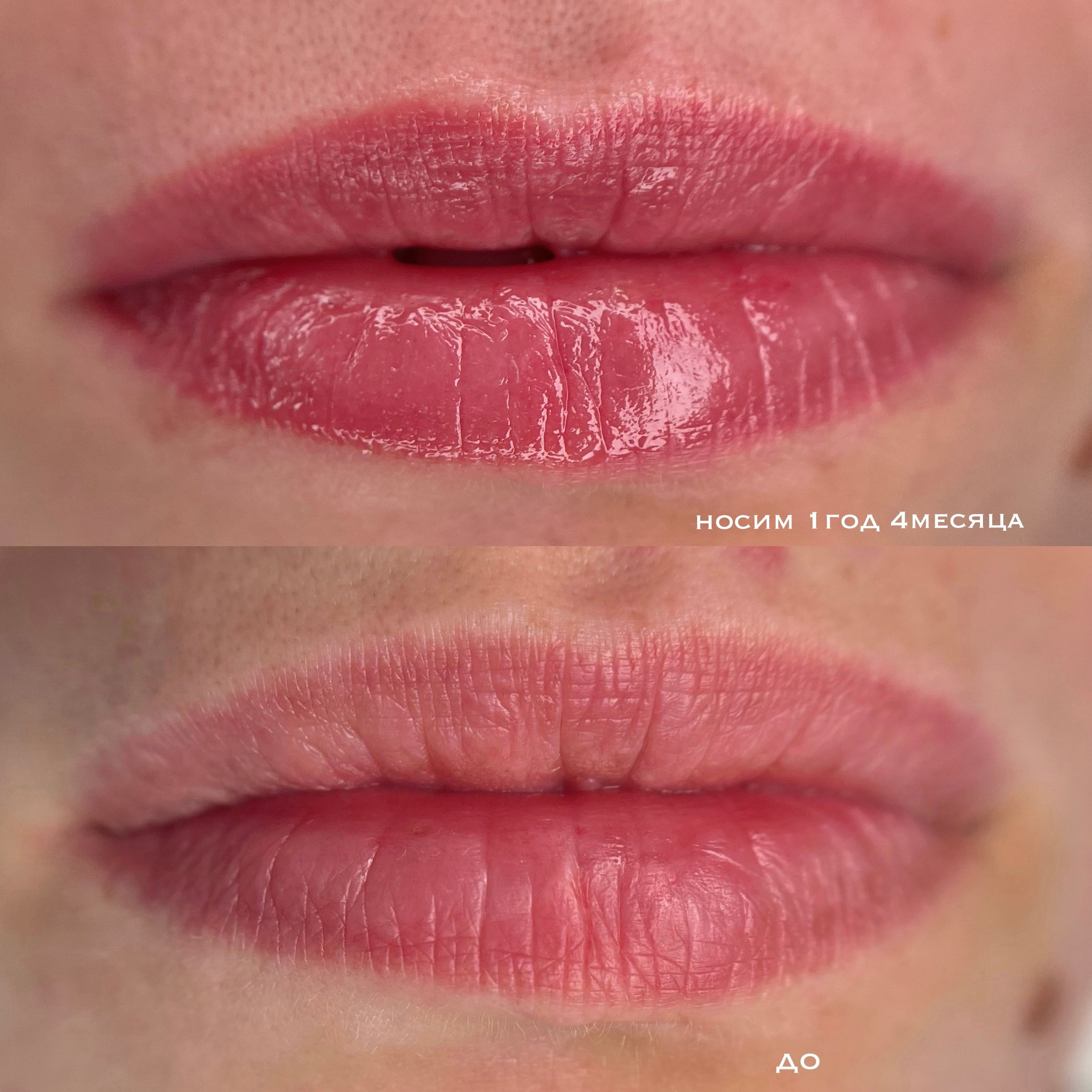 ГУБЫ зажившие. Перманентный макияж и удаление старого татуажа в Ростове-на-Дону Дарья Исакова