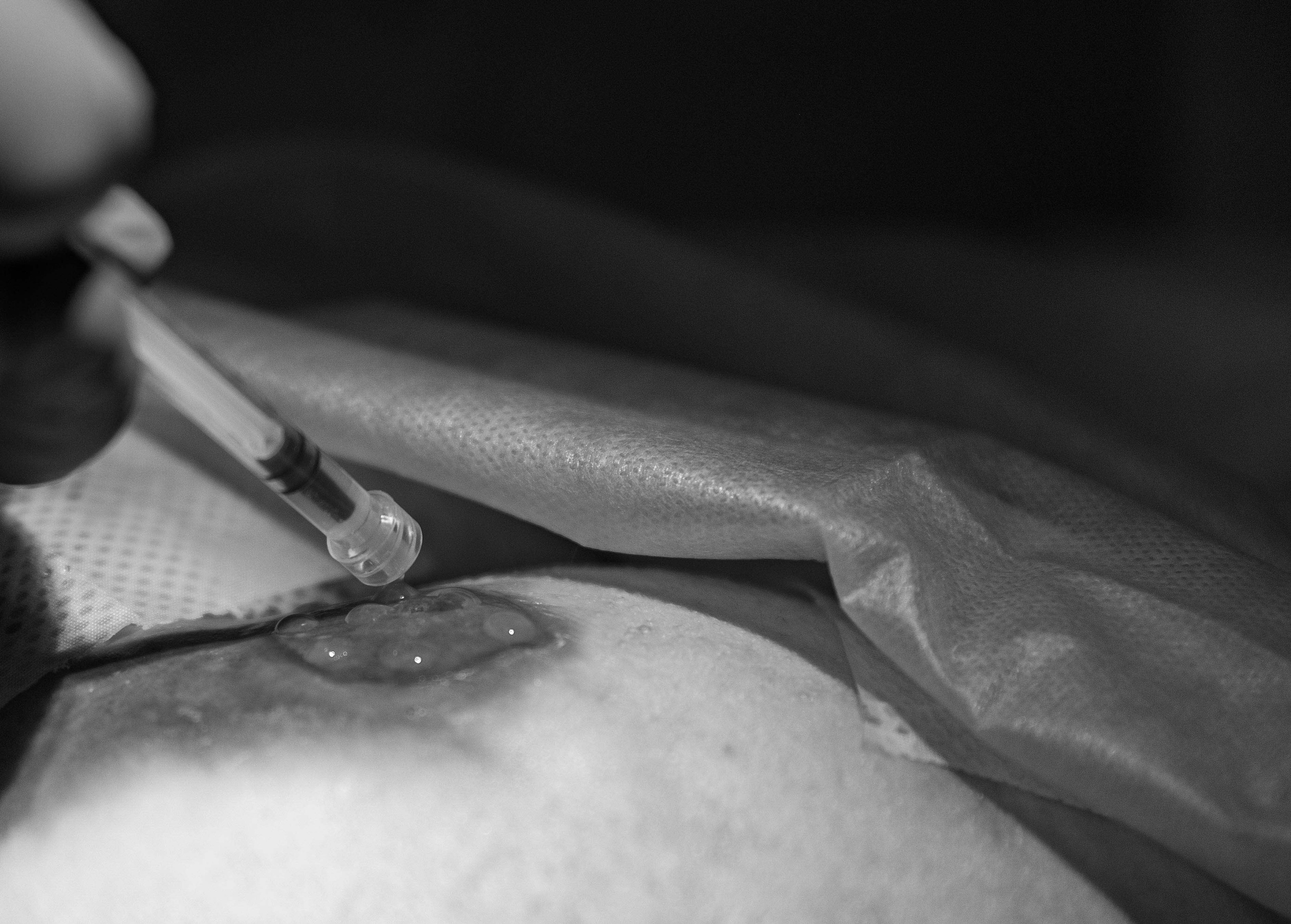 Лекарство для редких бабочек. Фотограф Виталий Верескун. Козельск-Калуга