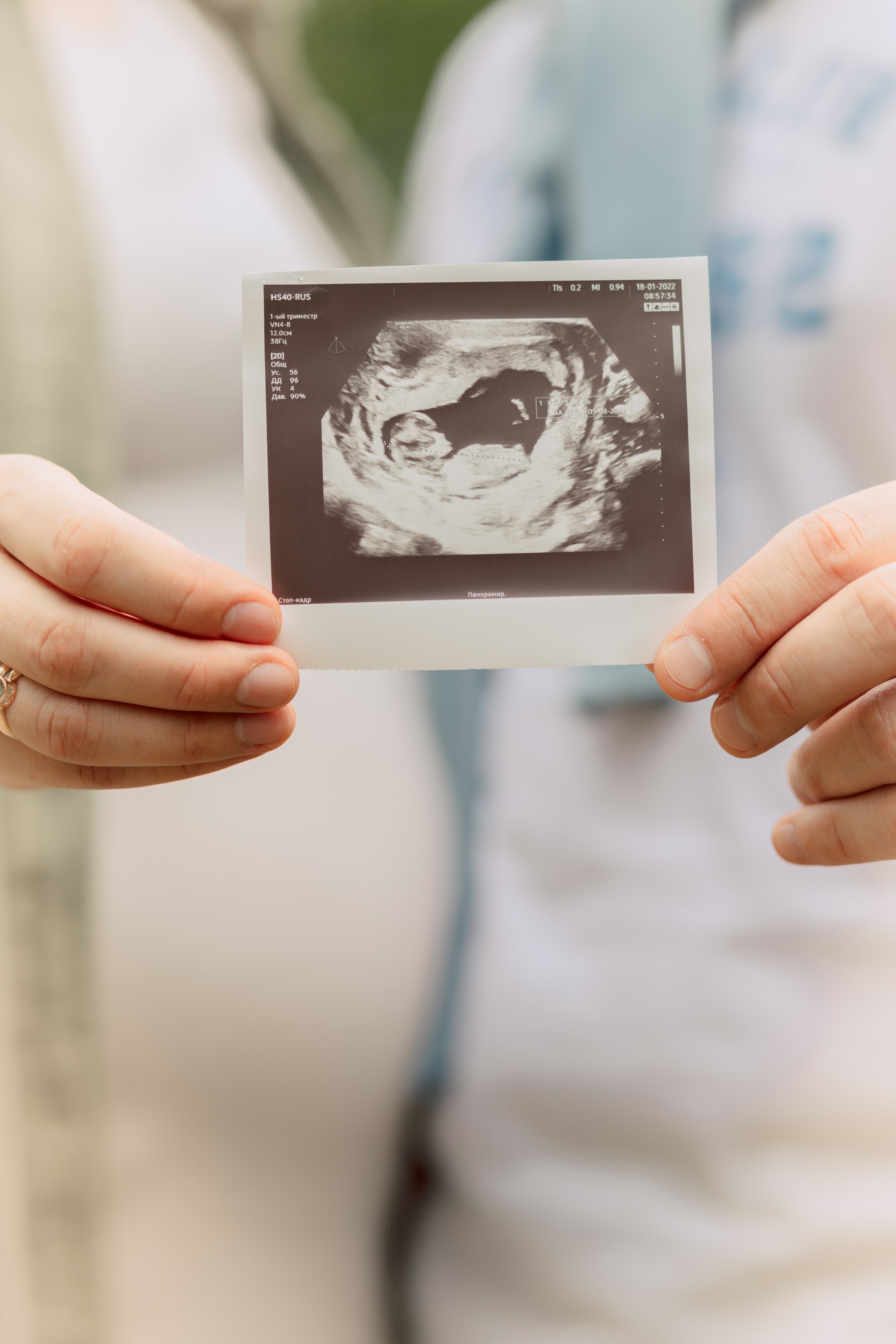 Юля и Владлен. Фотограф АняКа Мытищи