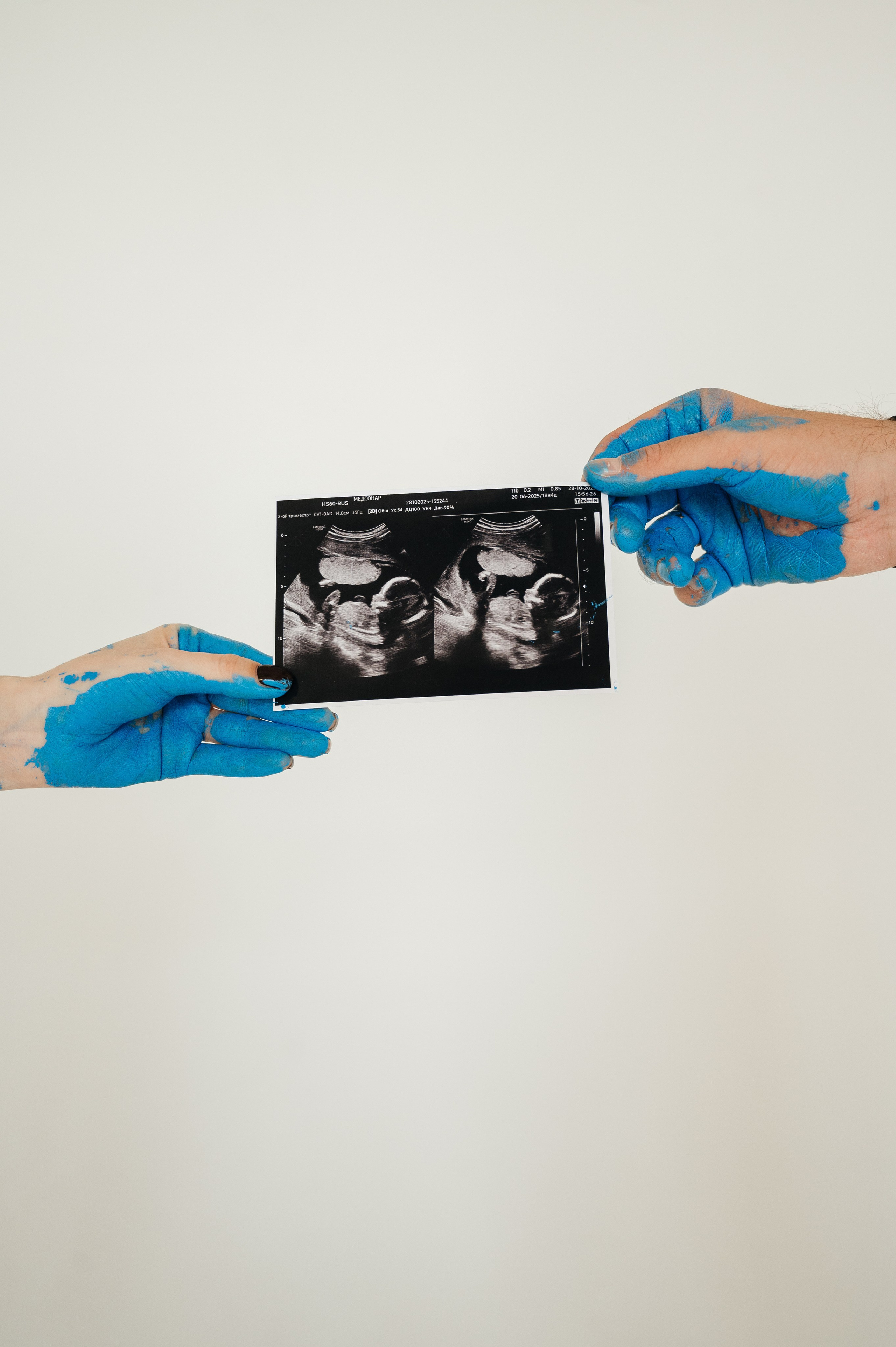 Гендер пати 🤍. Свадебный и семейный фотограф в Краснодаре Алина Мельник