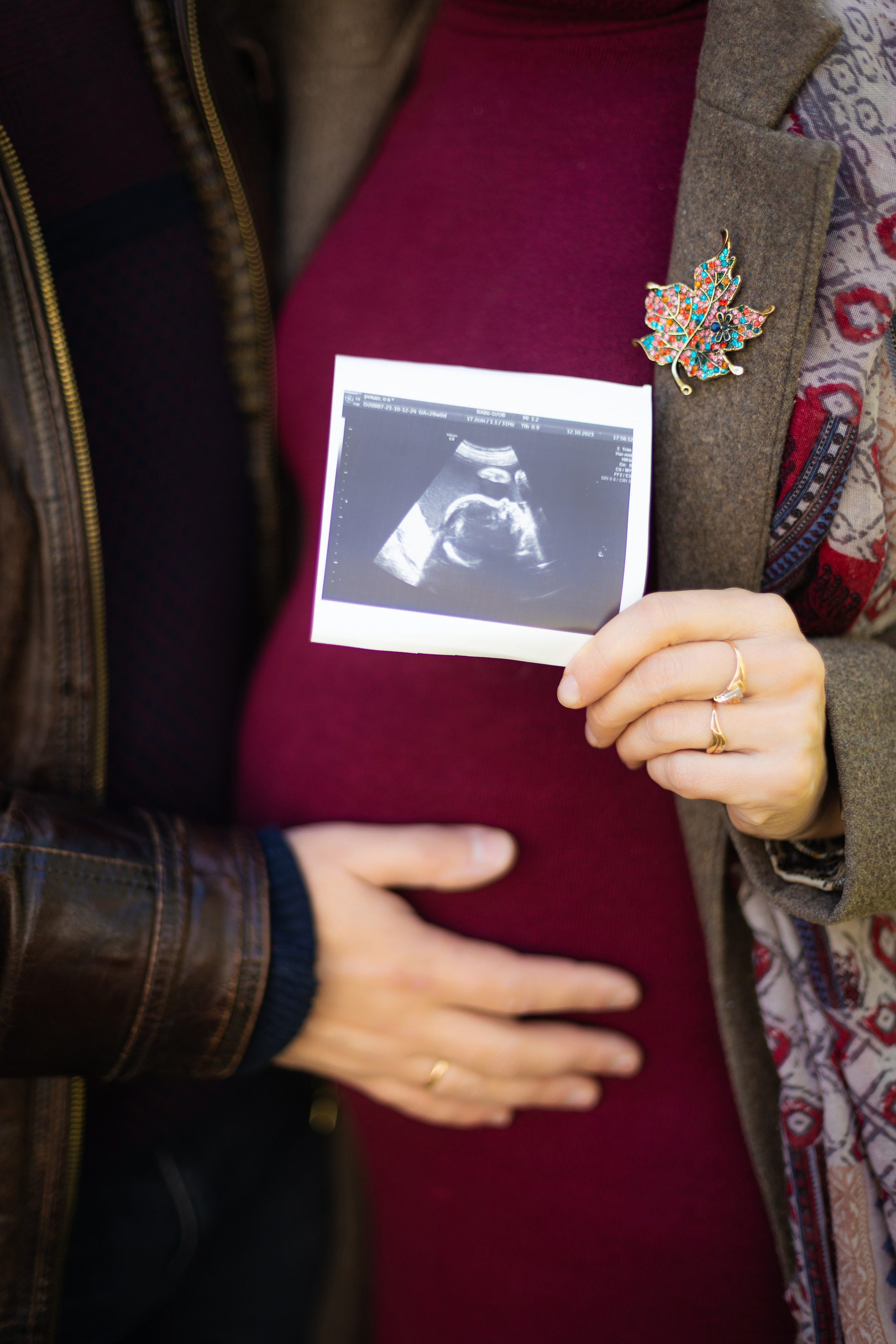 В ожидании малыша. Фотограф ВИКА МЕДУЗА