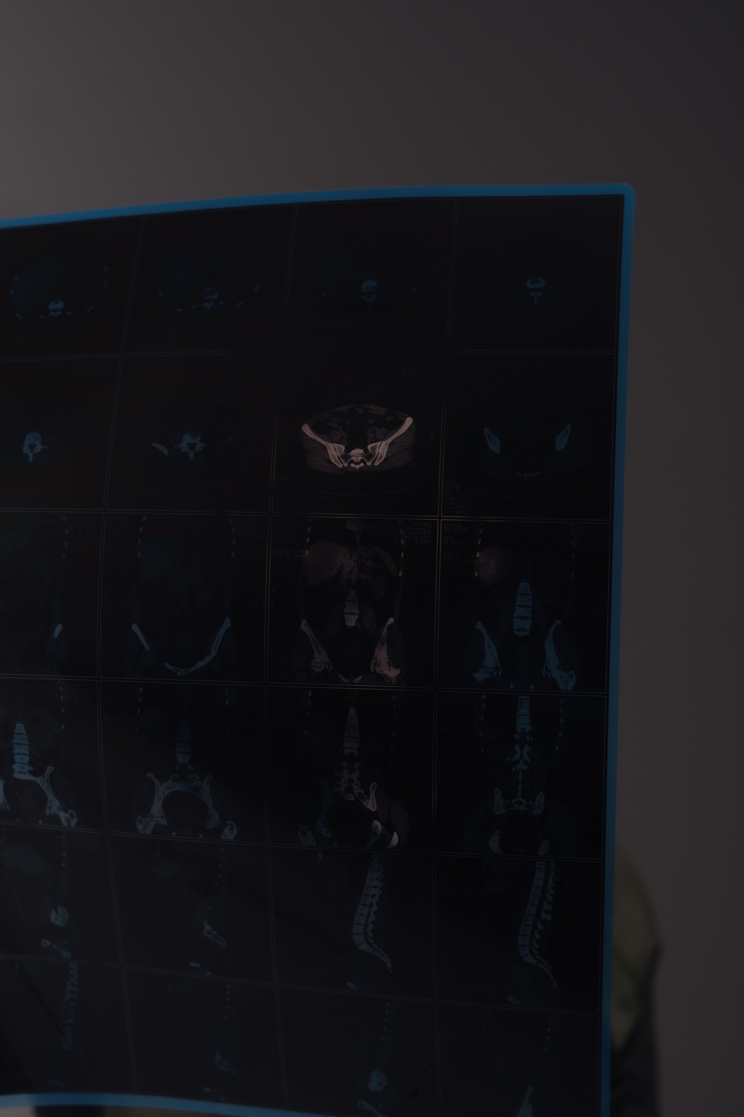 Сүйіндік Біржан Есжанұлы. Уличный и студийный фотограф в Астане Ержанов Нурасыл