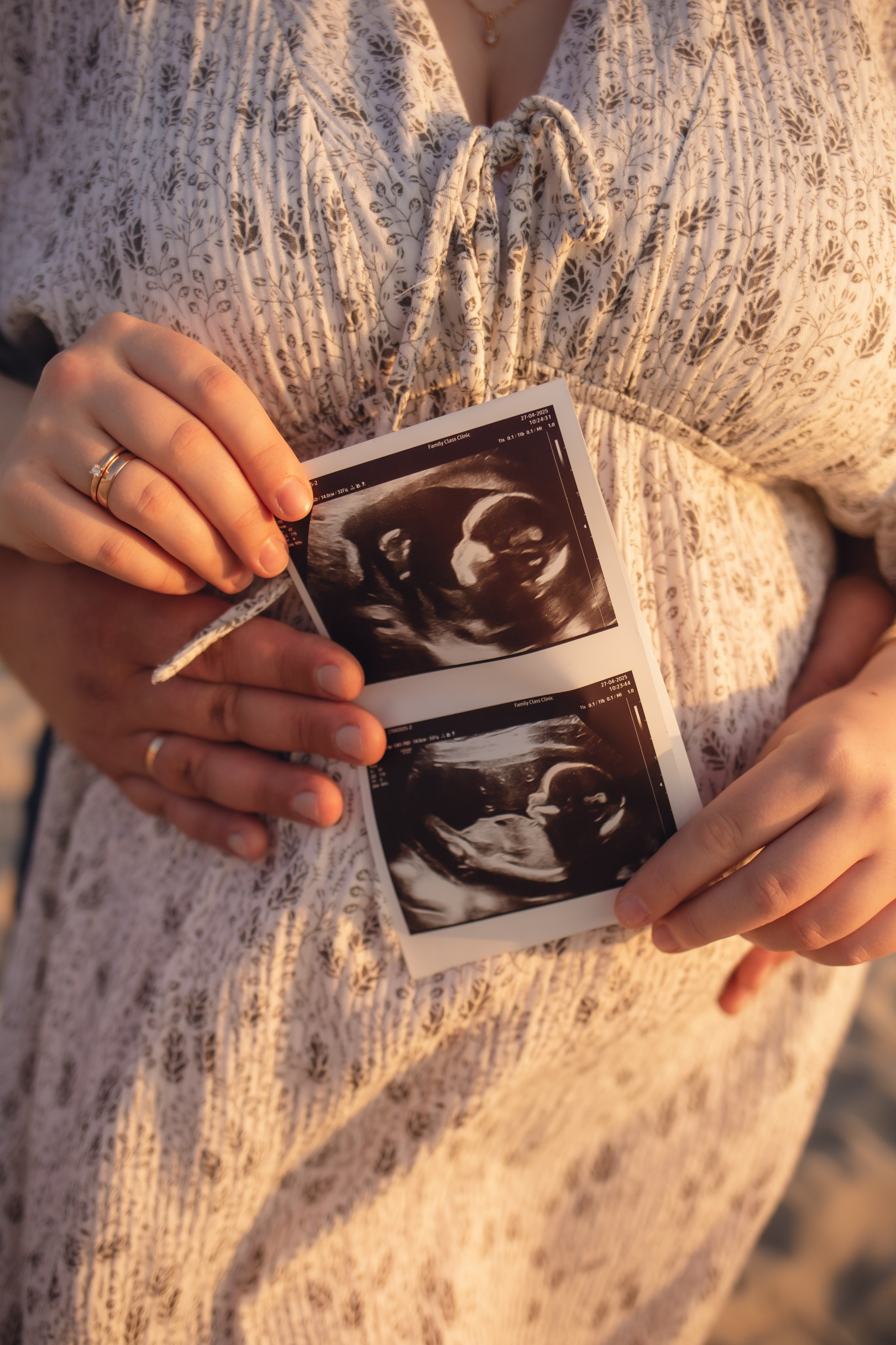 Елена и Никита. Фотограф в Калининграде Решетникова Алина