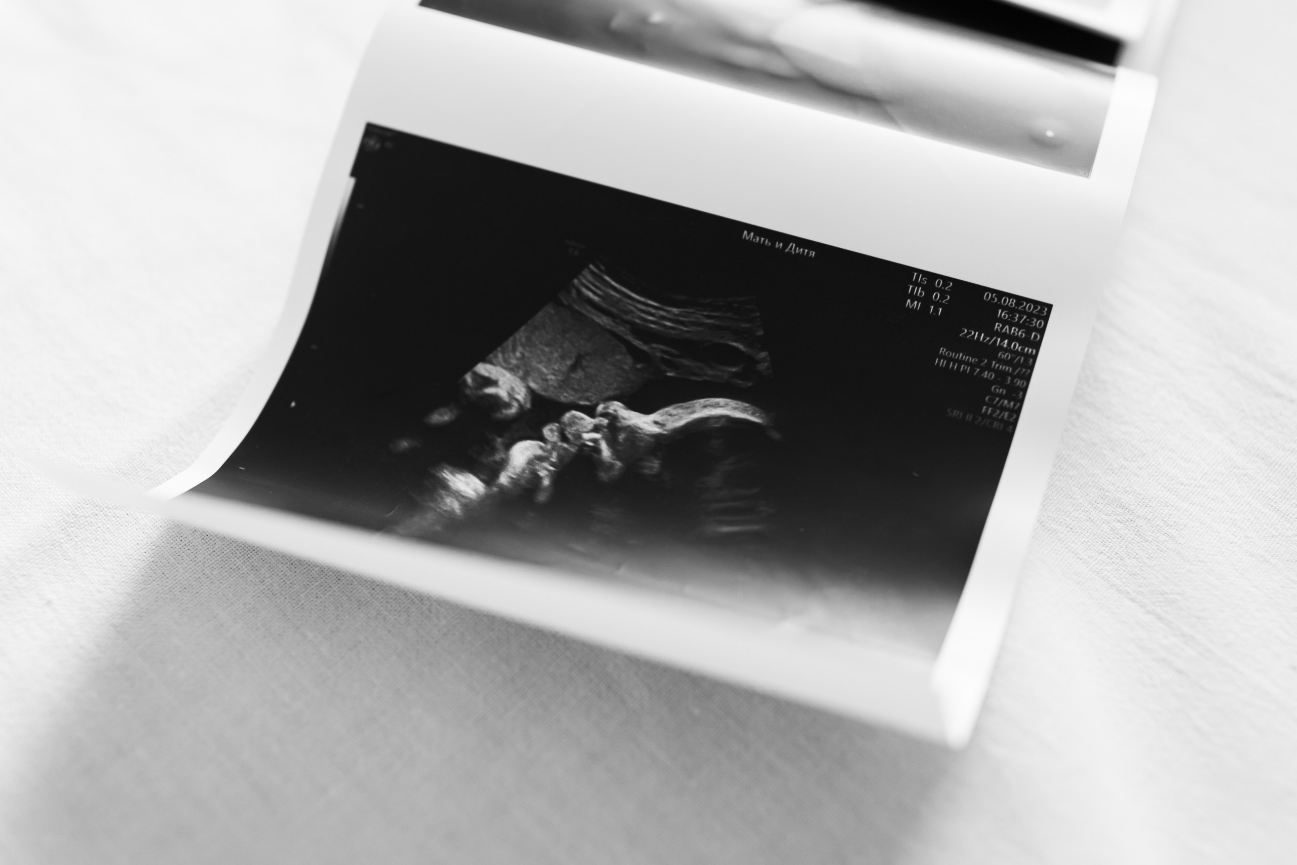 Рождение Маруси. Фотограф на роды в Санкт-Петербурге Екатерина Сысоева