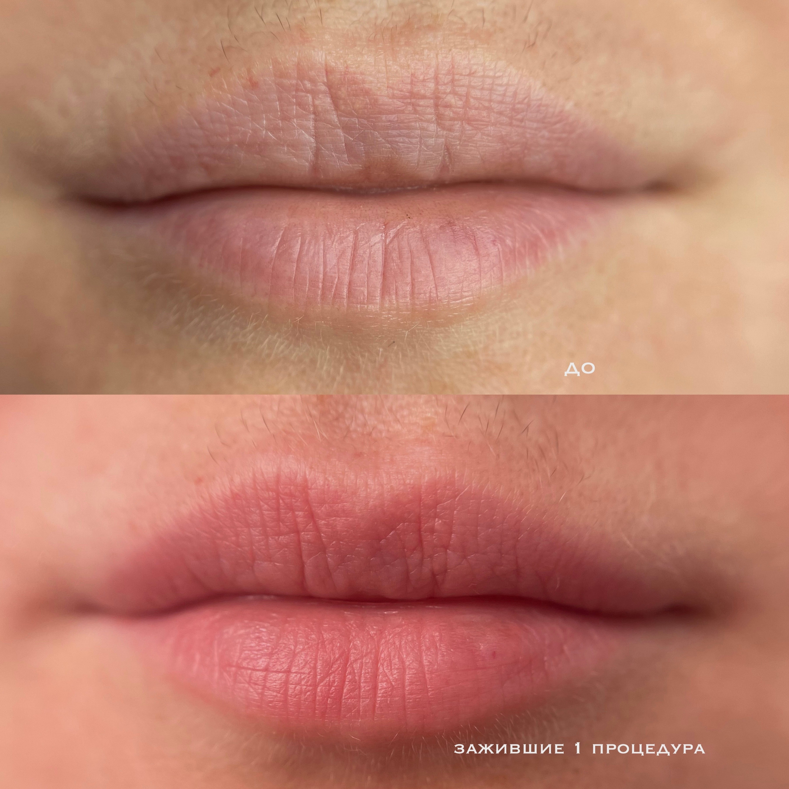 ГУБЫ зажившие. Перманентный макияж и удаление старого татуажа в Ростове-на-Дону Дарья Исакова