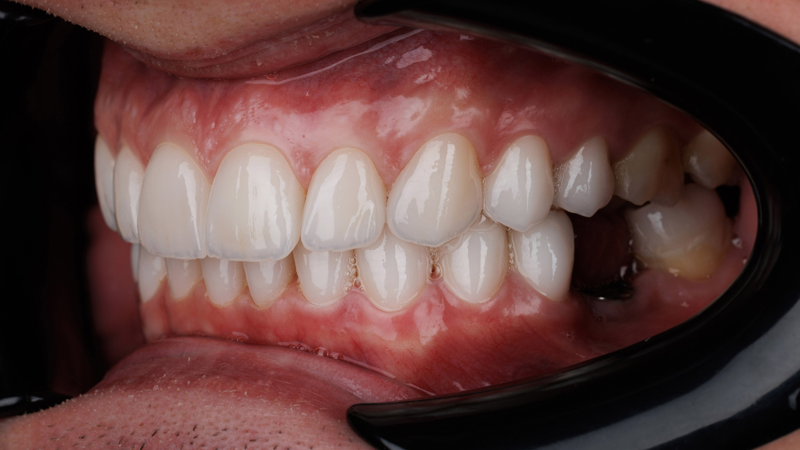 Ортопедия. Дентал фотограф — видеограф Денис Дорошенко