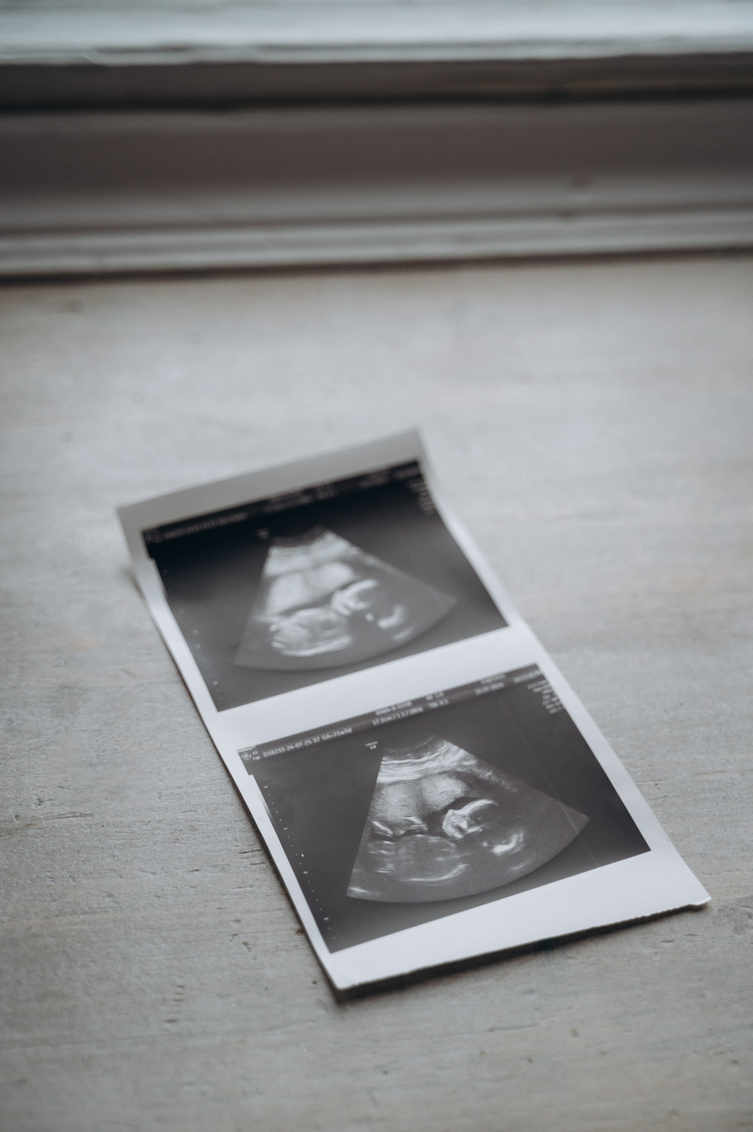 Виктория и Влад — в ожидании чуда. Семейный фотограф в Минске Дарья Дреко