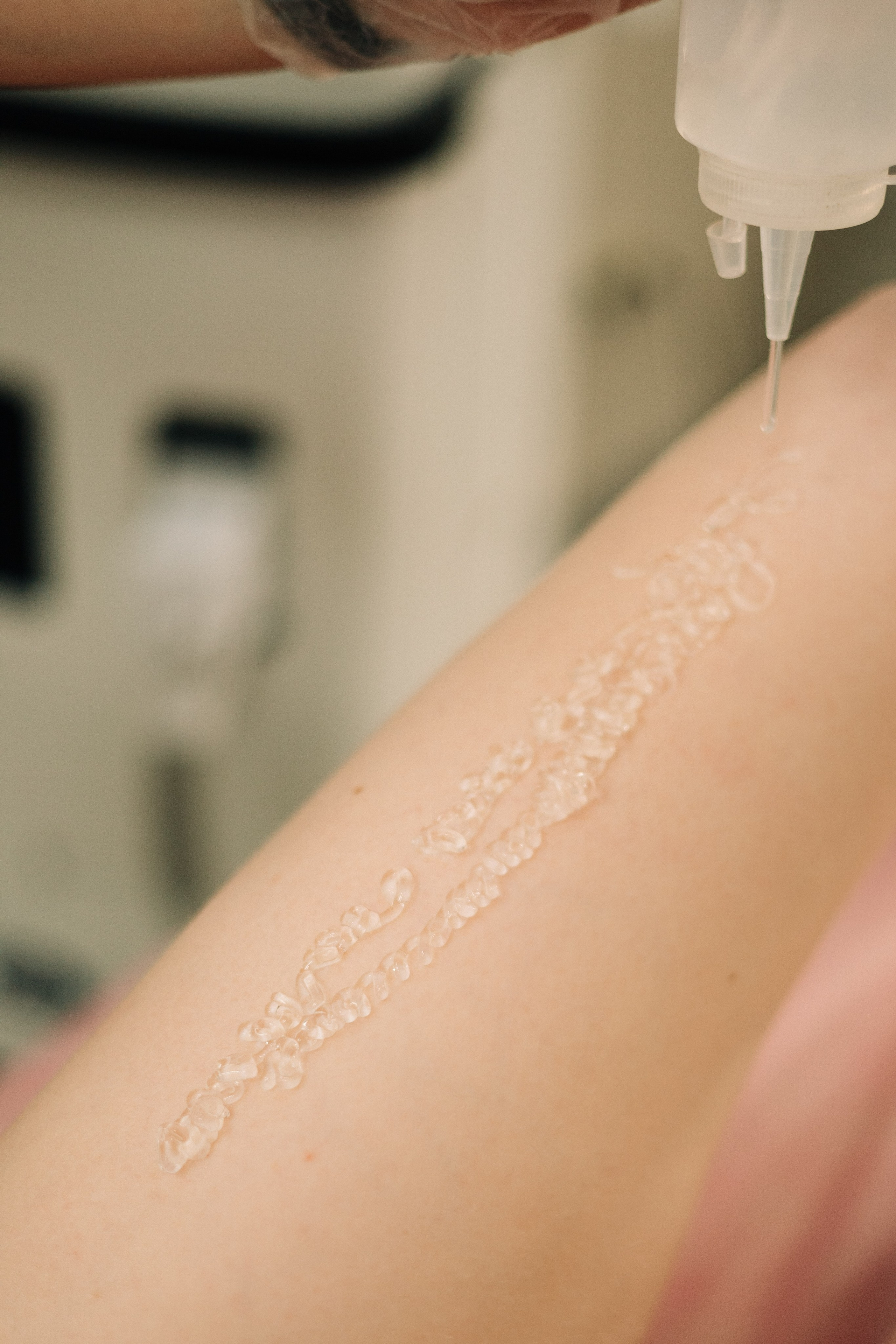 Студия лазерной эпиляции