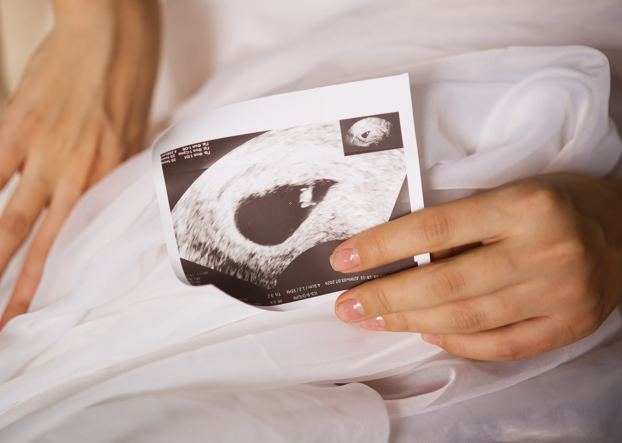 Алена. Портретный фотограф в Саратове Кристина Бузаева