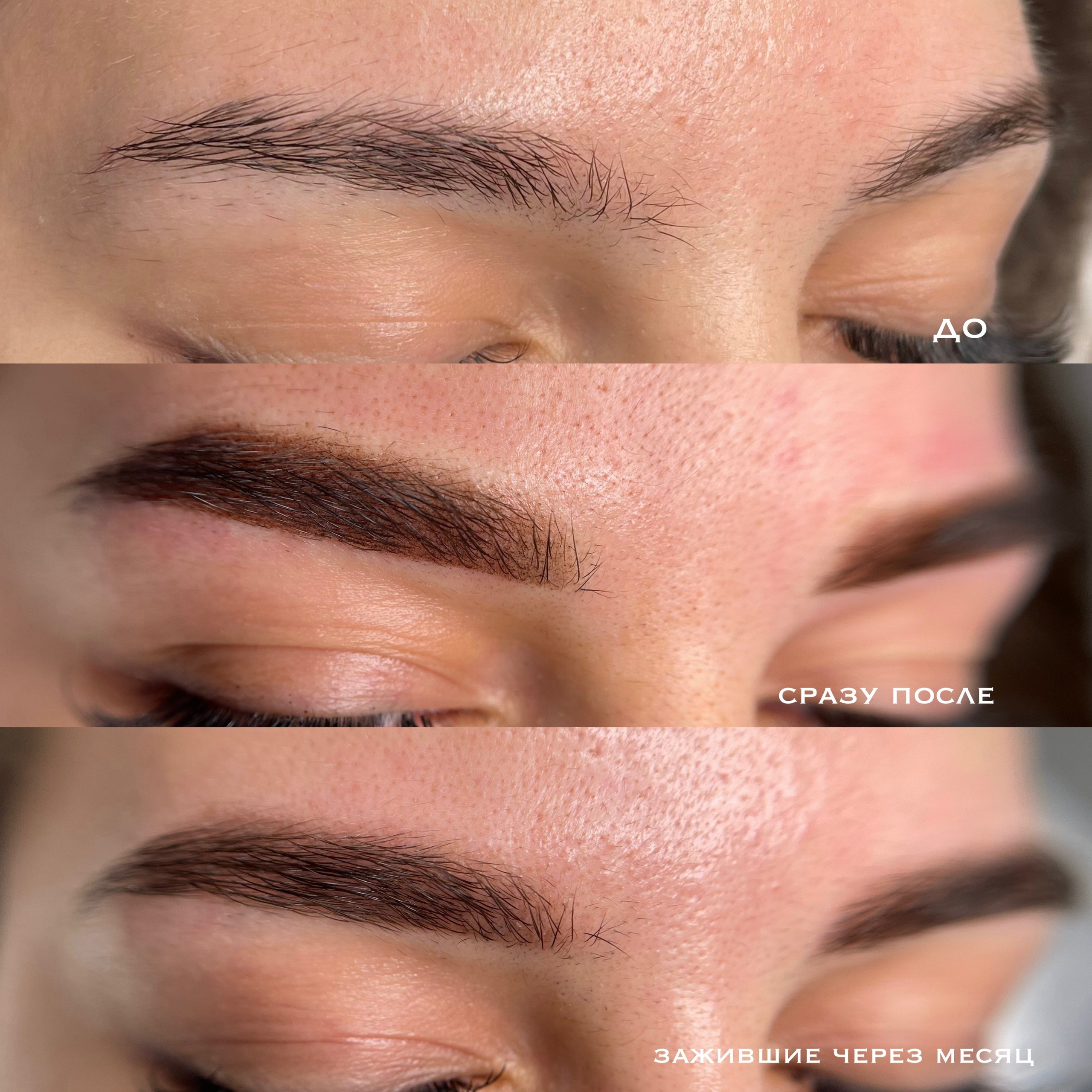 БРОВИ сразу после процедуры. Перманентный макияж и удаление старого татуажа в Ростове-на-Дону Дарья Исакова