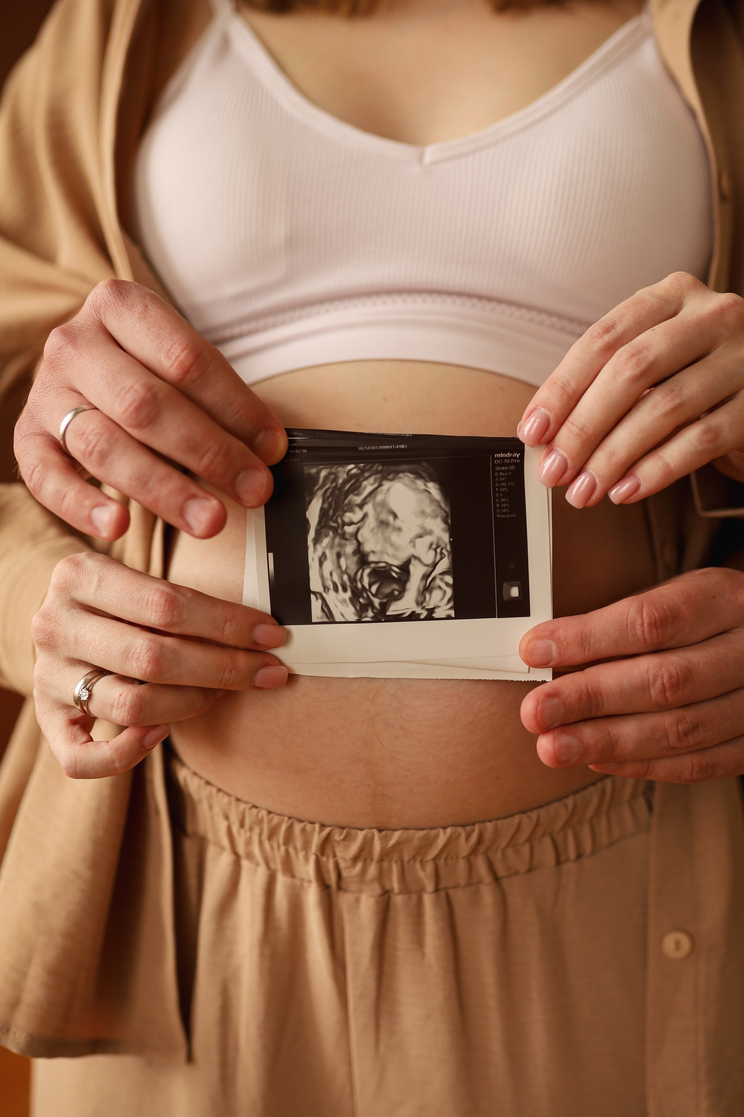 Юрий и Дарья. Инна Вильт| лайфстайл фотограф из Новосибирска