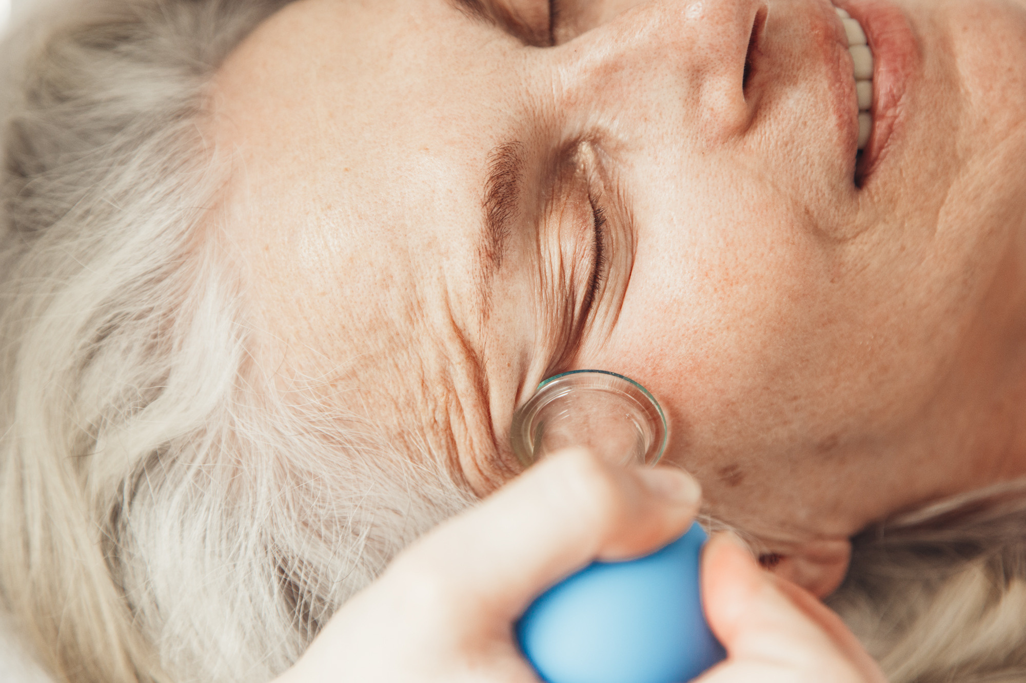 массаж лица вакуумной банкой