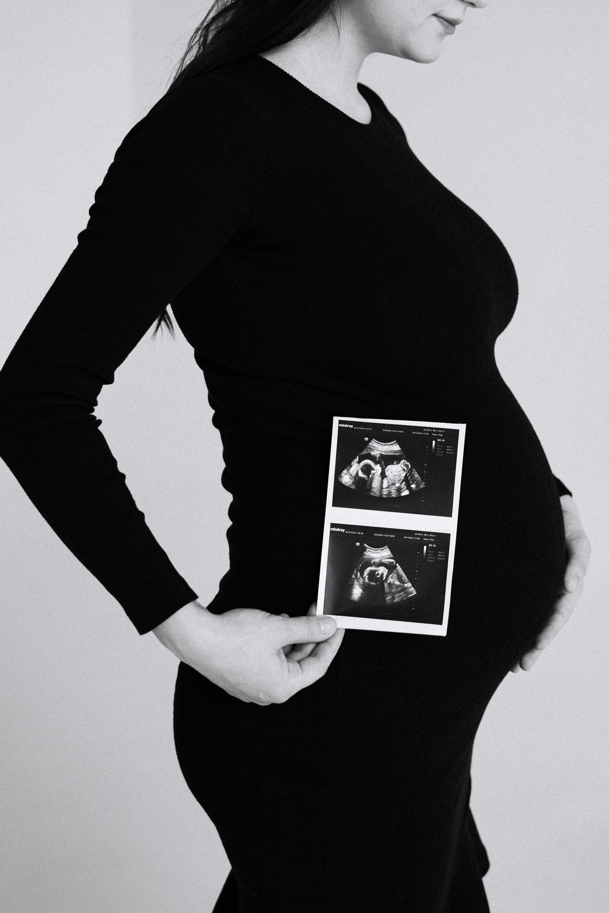 Александр и Дарья. Свадебный и семейный фотограф в Пскове и Острове Света Суворова