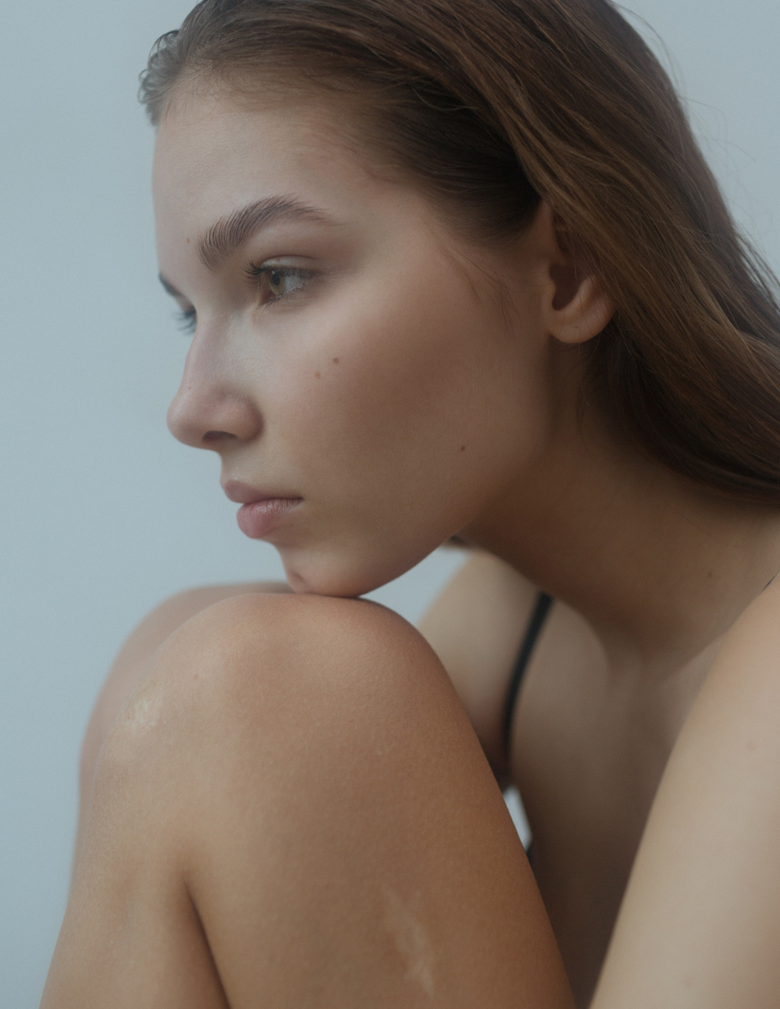 Портрет девушки со шрамом на коленке