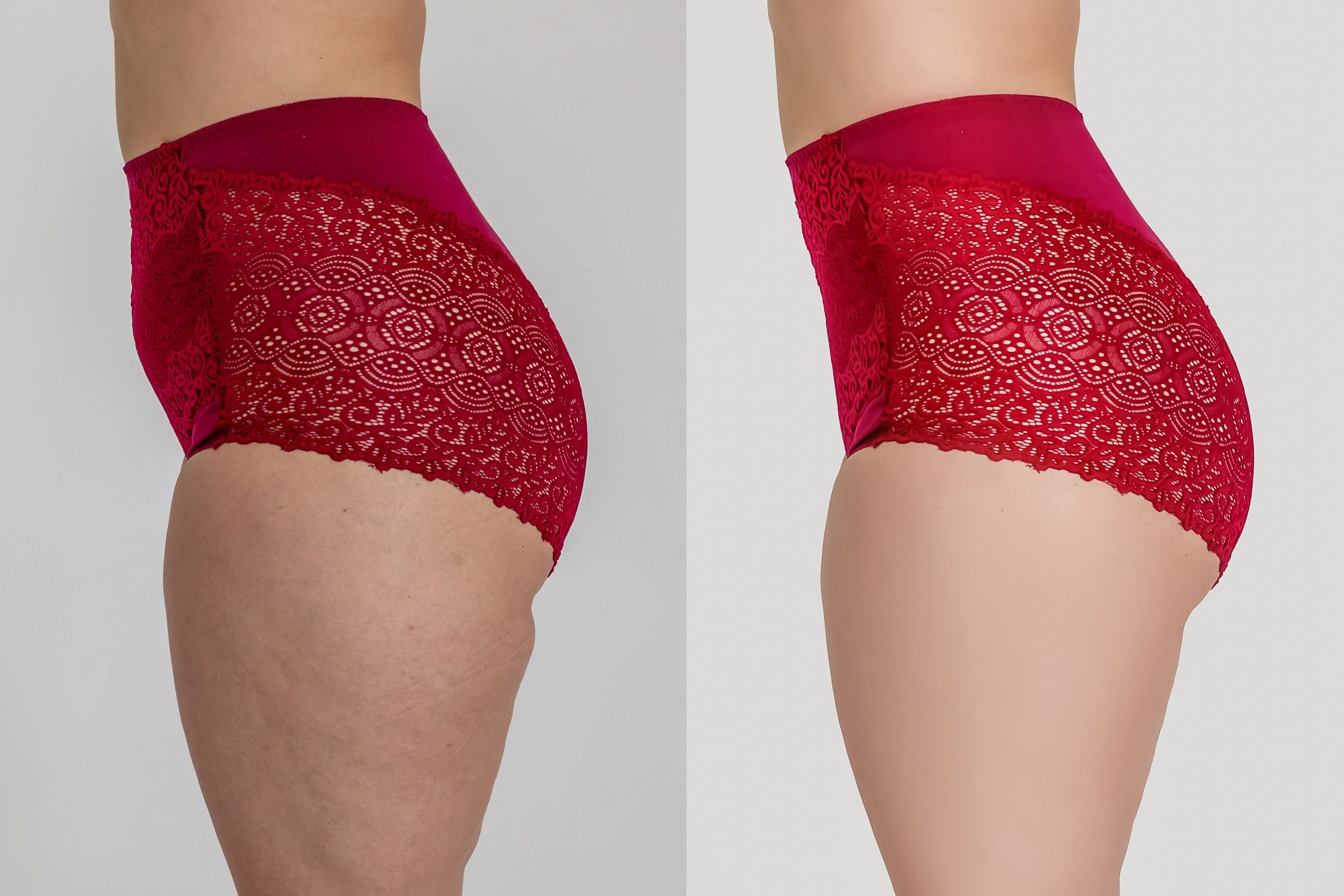 Деликатная обработка портретов для рекламы нижнего белья | Студия SVITHART